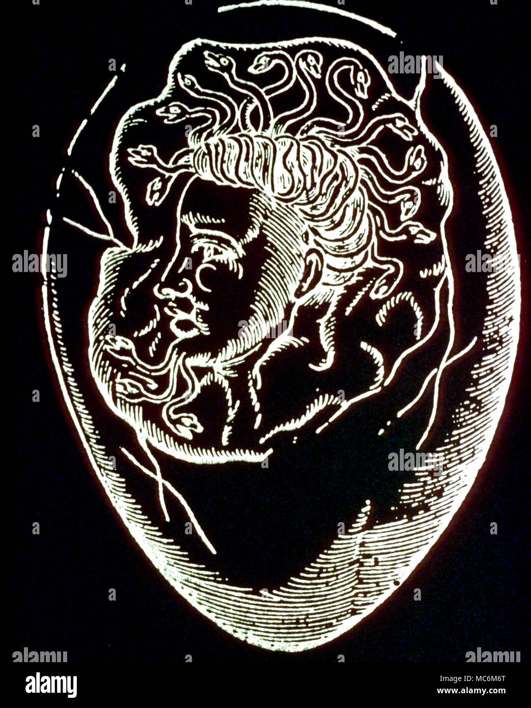Mostri - Testa in uovo. Strano monster - testa umana con capelli a serpentina - Trovato in uovo e registrati nel 1579 edizione di Ambroise Pare 'De Monstris ac Monstruosis'. Foto Stock