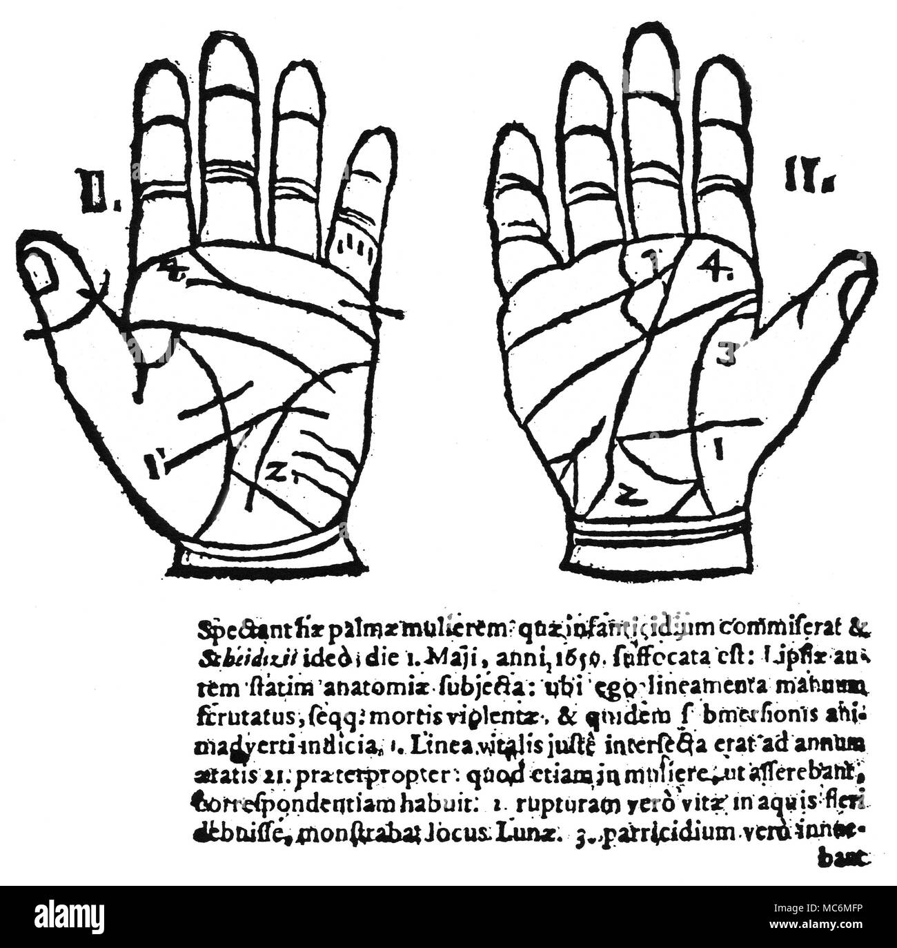 Chiromanzia - CHIROMANZIA medievale a due mani-diagrammi, da Praetorius, Ludicrum Chiromanticum, 1661. Le due mani si riferiscono a una donna che ha ucciso i suoi bambini. Foto Stock