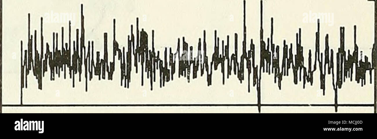 . 1.0 V La figura 7 - Rappresentante Film caldo segnali per i vari regimi di flusso i i . c MINAR            turbolento di ^, " """ - DF +DF(x) / / / /^ i 1 DFt ADT(SxC-X0) J 1 ' •7 i 1 ;Vs*e&GT; , 0 x" Figura 8 - Corpo idealizzato di una resistenza di attrito con la distribuzione di un viaggio di turbolenza 26 Foto Stock
