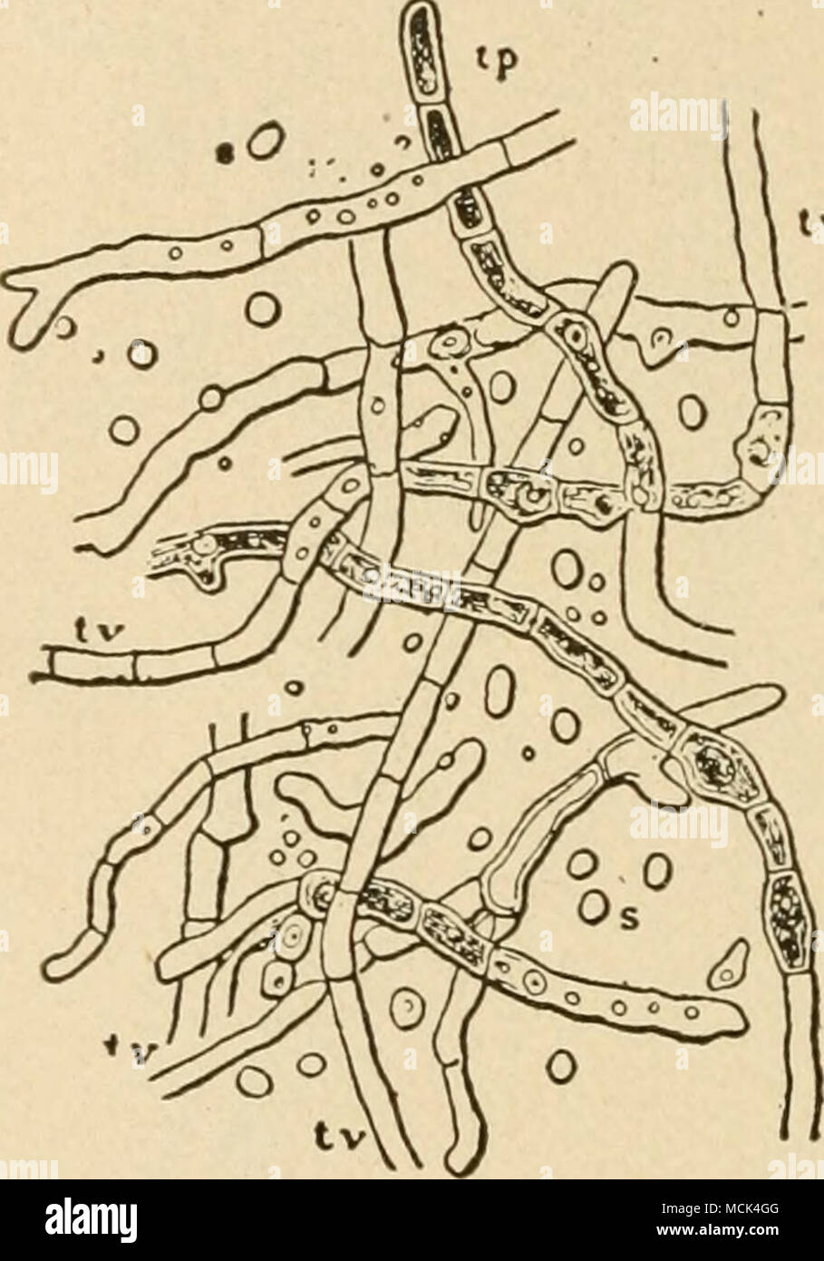 . Fig-. 54.-l'Achoiioii .Srlioii/iiiiii del favus di pollame; mag-nified 800 diametri. tT tubi vuoti; //, tubi riempiti con protoplasma e contenente spore; s, iso- affini spore. Foto Stock