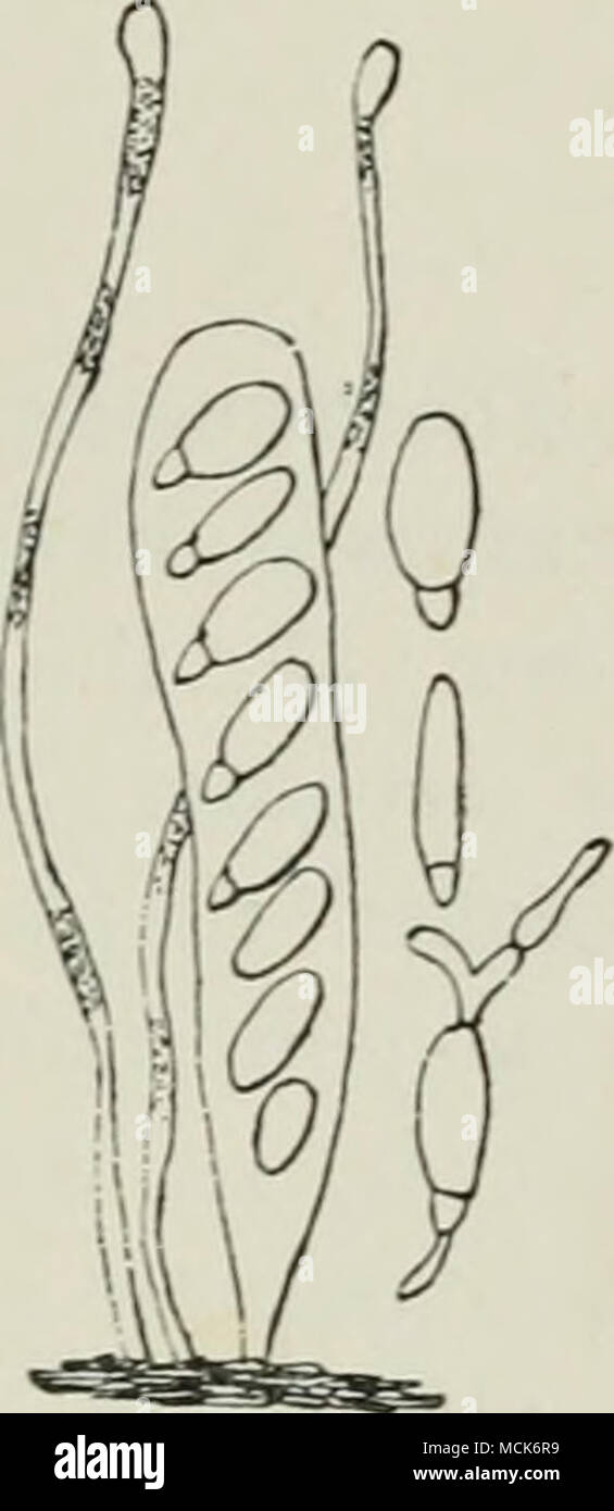 . Fig. Wb. - PloKfirjhtia mor- Ijosa. Aschi, con otto spore. Spore in germina- zione. Filamentosa para- physes. (Cop. Da Farlow). Fig. 114.-PloKcightia morbosa. (V. Tubeuf phot.) e pregiudizievole ampiamente distribuito la malattia delle varie specie di Prunus, soprattutto prugna e ciliegia. I rami vita e rametti di diventare rivestita con una crosta di presenta verrucosa escrescenze, e allo stesso tempo sono più o meno addensate e deformato. Un micelio permea i tessuti di quelle di ramoscelli gonfie e forme nero stromata croccante in cui perithecia sono incorporati. Il perithecia contengono paraphyses semplice e gie Foto Stock