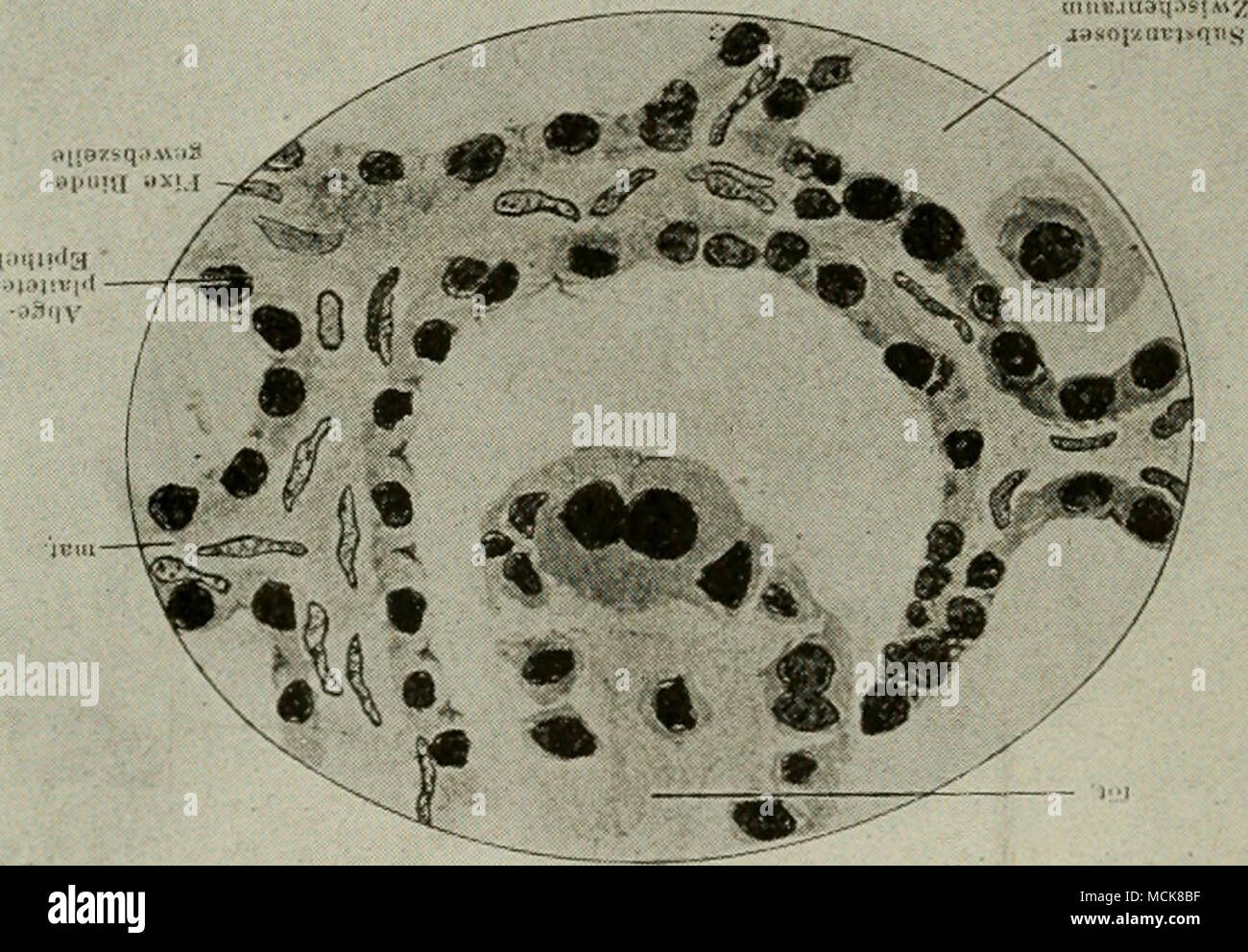 Fig. 34. La stessa della Fig. 33. x 900. (Pomayer). come una unit, ovviando in gran parte qualsiasi trascinando su la placenta che potrebbe minacciare di arrecare un grave pregiudizio ad Fig. 34. La stessa della Fig. 33. x 900. (Pomayer). come una unit, ovviando in gran parte qualsiasi trascinando su la placenta che potrebbe minacciare di arrecare un grave pregiudizio ad