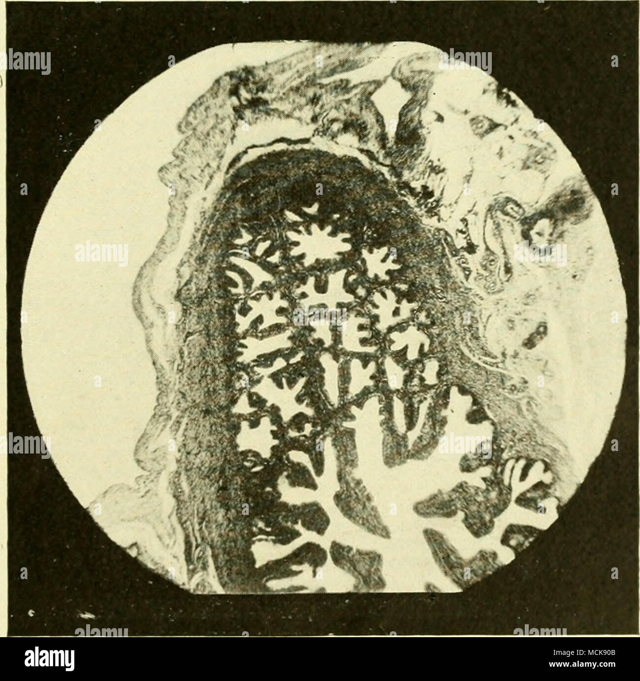 . Fig 143-sezione normale di Ovidotto che mostra la formazione di cavità Cyst-Like per coalescenza delle pieghe. salpingite, ma di solito sono in numero maggiore e accompagnata da altre variazioni patologiche. Lo strato superficiale dell'epitelio è costituito da alte cellule, la maggior parte dei quali sono ciliate, anche se non vi è molta differenza di opinioni in merito all'iniezione di capitale- zione di quest'ultimo. In animali più vecchi, ci sono solo due o tre strati di cellule al di sotto di una superficiale; mentre nel giovane di 28 Foto Stock