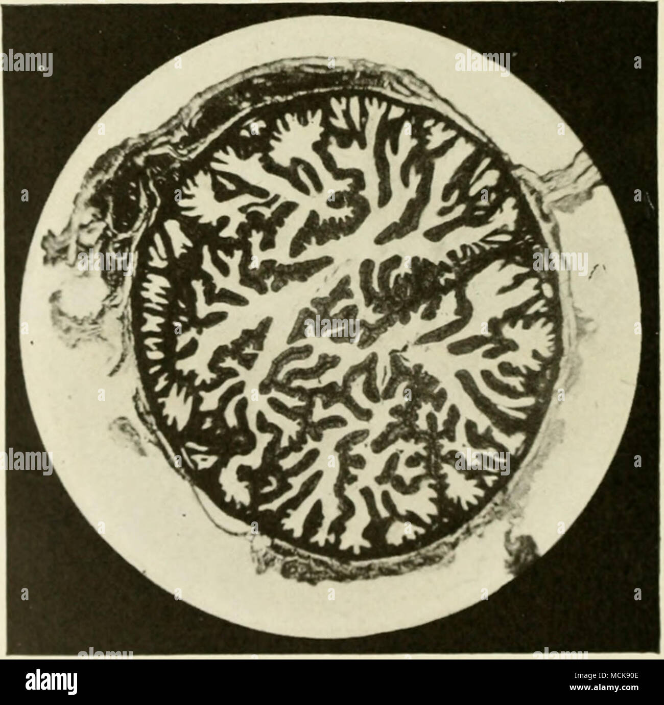 . PlG. 1 j8 sezione trasversale di normale Ovidotto vicino l'ampolla. Mostra Uk- il numero e la complessità delle mucose pieghe. plex anatomo-fisiologici barriere tra il peritoneale e cavità uterina. Tecnicamente, la cavità peritoneale della femmina comunica con l'esterno attraverso il r il normale e patologica di istologia e per la batteriologia del oviducts, sono riconoscente soprattutto al lavoro del Dott. Herbert L. Oilman, studente laureato, e al mio collega, ho&GT;r. C. M. falegname. Foto Stock