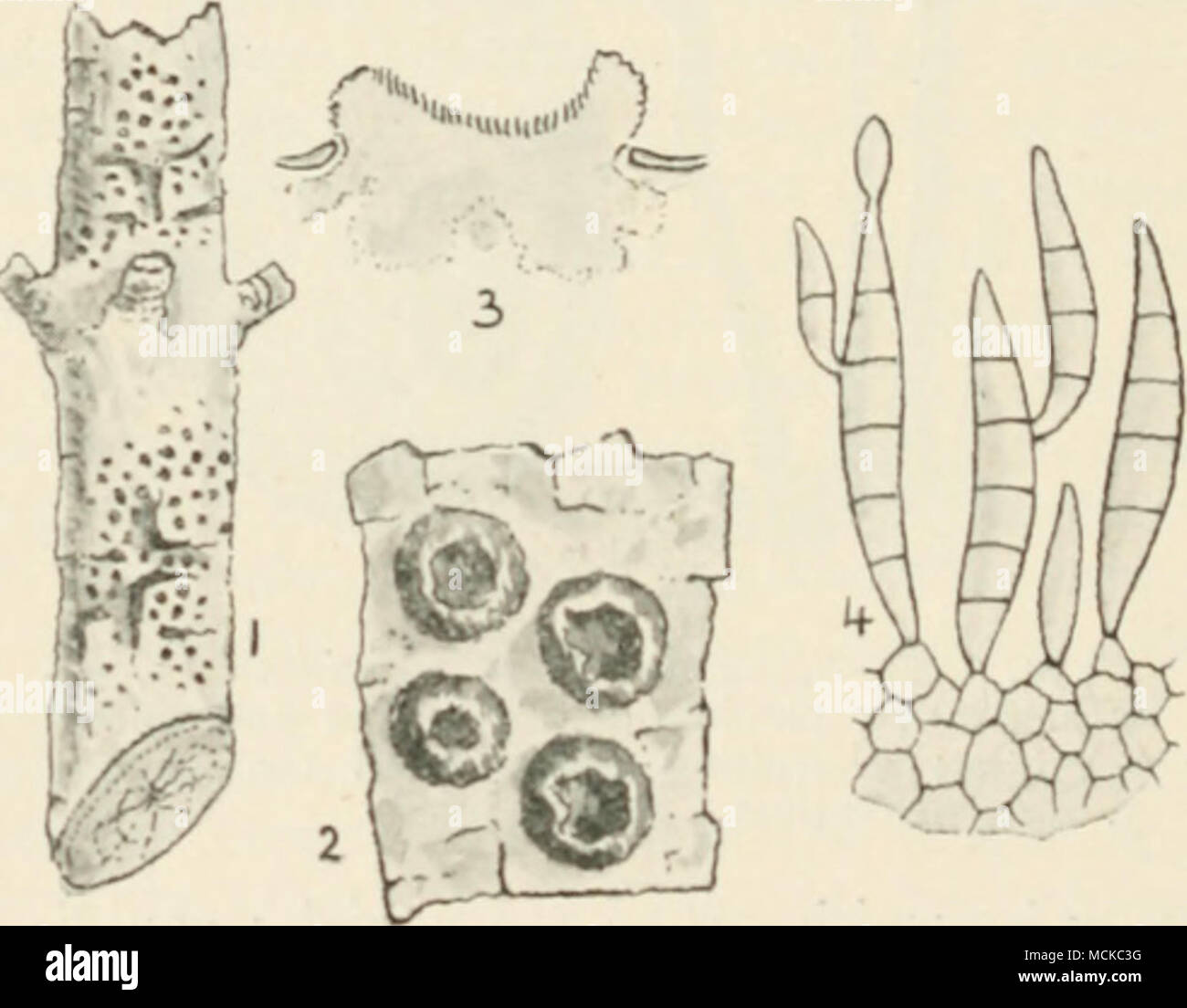 . Fig. I.J3.âExosporium laricinum. i, fungo su pine *â b.irk ; 2, frutto del fungo ; 3, sezioni della stessa ; 4, conidi. I FIGG. 2-4 mng. 1 La batteriosi vascolare fungo {Dayscyp/ui) per ottenere un ingresso nei tessuti, e successivamente formare una batteriosi vascolare ferita. Il fungo si verifica tlie sotto forma di minute, punti neri nelle affollate in cluster su corteccia di giovani germogli. Lo stroma più o meno circolare, spesso premuto al centro, e rassomiglia Foto Stock