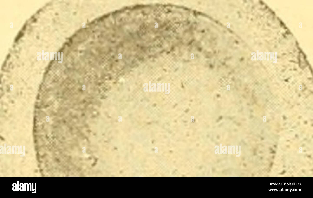 . Â¢è¦ãéã"ä'aeae' .ãåç²¾aeç¾è±¡ Aaeçåµäº(ae¯éã" é"çã"è¦Sãã¯ç²¾ è"ã®é -é¨ãªW Bãcåç²¾å¾ç²è³ªae¨£ç© å½¢aeã®éä'- Dç²è' ç©å½¢aeçµãª ãªã£ ã¦ä¾ããç¬¬ä'åC)ãããã¦ae¼'. Ã¿ã¦ãã¹ã®åµå-ã®åç²¾ä'¦ã³ã"å ¶ã®åå²ã"å°±ã¦(ae°'äºã ã¤ã¦ã ä¾¦éã"ae¯ã®å °ç"¯ã®èè¿è¢"ãµã"è³ãã°ãä"è¿ä'è¦åã§ãã¤ ãè¼ªå"ãae-£åã"ãª.^åµã®è¡¨é¢ã©å¹³è¡ããae¨£ ã"ãªã(ç¬¬ä' åD)åç²¾-ãã¦ããae-¤ã®å¦ãçae ã"éããè¿ã®aeéã¯å åä¹è³åäºåãè¦ããã ae-¤ç²è³ªaeª¨ç©ã¯ä½ç©Vããç¥ããªããä'çç²¾è²ãé²å ¥.ãã¦ã ãä"ã®ç²¾è²ã®é²å ¥ãé²ãVãããµåµèã®å¦ããã®ã§ã¯ãã ã¾ãããèãã¦çã"ç²è³ªae¨£ç©ã©è¨ãµaeä"¥ã¯ae-¤ç©è³ªãç²ç åãaeã£ ã¦å± ãããã§ãããae ã"ä¹ã"å¡µåç aeµç-ãéç ããã°å®¹aeã"åããªããååµãaeªã åç²¾ãããªãã§è¡¨é¢ã" ae¯ã®ããéã¯ã¨åºã"ae©"ã¯ã£ Foto Stock