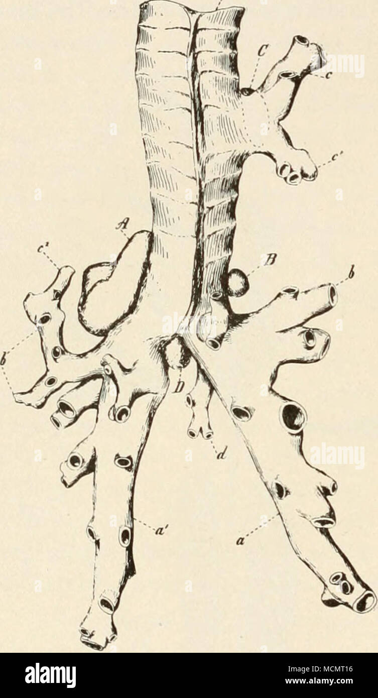 . Fig. 33. Trachea e bronchi, dei polmoni di bovini shoiving attaccato ghiandole bronchiali, (a-a') Alimentazione destra e sinistra lobi caudale, {b.b') alimentazione r. e I. ventrale di lobi, {c-c') i rami del diritto bronco in soprannumero, ((C=) alimentazione sinistra lobo cefalico, {d) ramo al lobo azygous, {e) trachea. A. sinistra linfonodi bronchiali premistoppa. B. Diritto linfonodi bronchiali premistoppa. C. ghiandole linfatiche base di bronco supranumerary. D. premistoppa betiueen spesso dei bronchi. Le ghiandole A. D., sono spesso coinvolti {Smith). Foto Stock