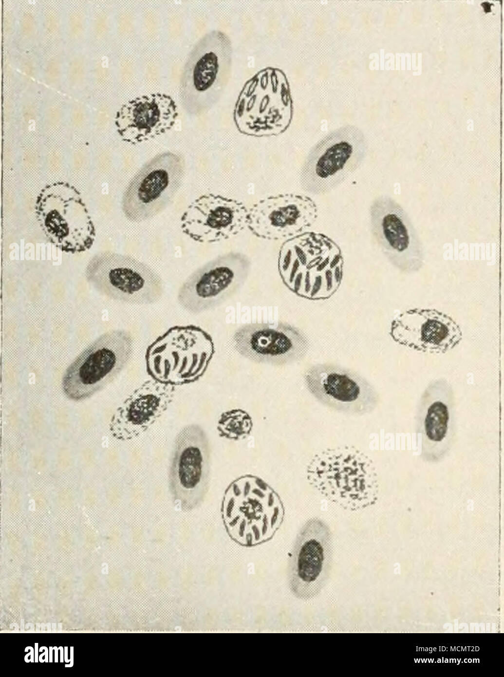 . Fig. 17. Il sangue da un iv ell caso avanzato di galli e galline il tifo che mostra i globuli rossi^ lastre di sangue e aumento del numero di leucociti. Numero di Numero di Data tempera- ture (F°.) rosso cor- puscles, per c. mm. bianco cor- puscles per c. mm. Commento Feb 6 livello di 107,4 3.744.444 21,222 bene. 7 : 109 3.417,391 26,087 apparentemente' bene. 8 1 108,2 2,784.700 55.000 fare. 9 Io 108.4 2,807,692 76,925 fare. 11 1 livello di 107,4 3.481,818 90,909 piume increspato ; rifiuta il cibo. 13 1 110,2 2,133,333 100 000 molto tranquillo ; pettine pallido. 14 1 108 2,530,000 140.000 galline morirono più tardi nella giornata. Foto Stock