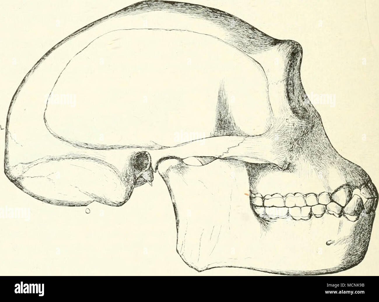 . Fig. 567. Versuch einer Rekonstruktion des Schädels von Pithecanthropiis erectus. V2 J^- Gr., nach E. Dubois. C Sutura coronalis; L Sutura himbdoidea; o il foramen magnum. O = hinterer Rand des foramen magnum ist etwa um 3 min zu hoch gezeichnet und der hintere untere Teil der Linea temporalis um 3 mm zu tief. das recente genere Anthropo])ithecus Blainv. (L'roglodytes H Geoft'r.), Eng. Dubois wies dann aber nach, dass sie sich von diesem genere wesentlich unterscheide und stellte den ursprünglichen (ienusnamen wieder lei. da Foto Stock