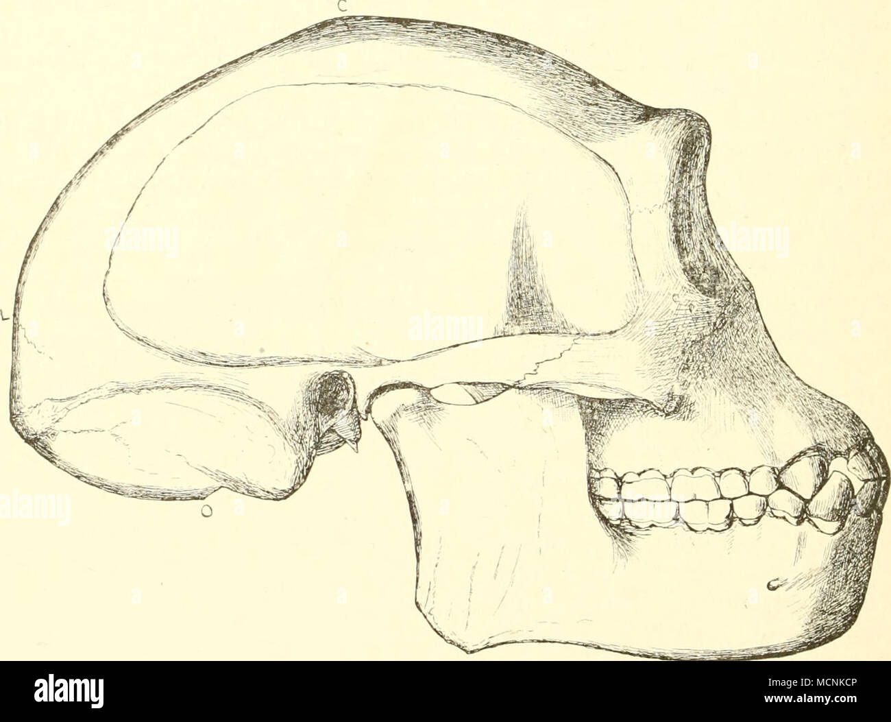 . Fig. r)67. Versuch einer Rekonstruktion des Schädels von Pithecanthropns erectus. '/, N. Gr., nach E. Dubois. C Sutura coronalis; L Sutura lambdoidea; O P^oramen magnum. O = mano hinterer des Foramen raagnuni ist etwa um 3 mm zu hoch gezeichnet und der hintere untere Teil der Linea temporalis um ?, mm zu tief. das recente genere Anthropopithecus Blainv. (Troglodytes E. Geoffr.). Eug. Dubois wies dann aber nach, dass sie sich von diesem genere wesentlich unterscheide und stellte den ursprünglichen Genusnamen wieder lei. da Foto Stock