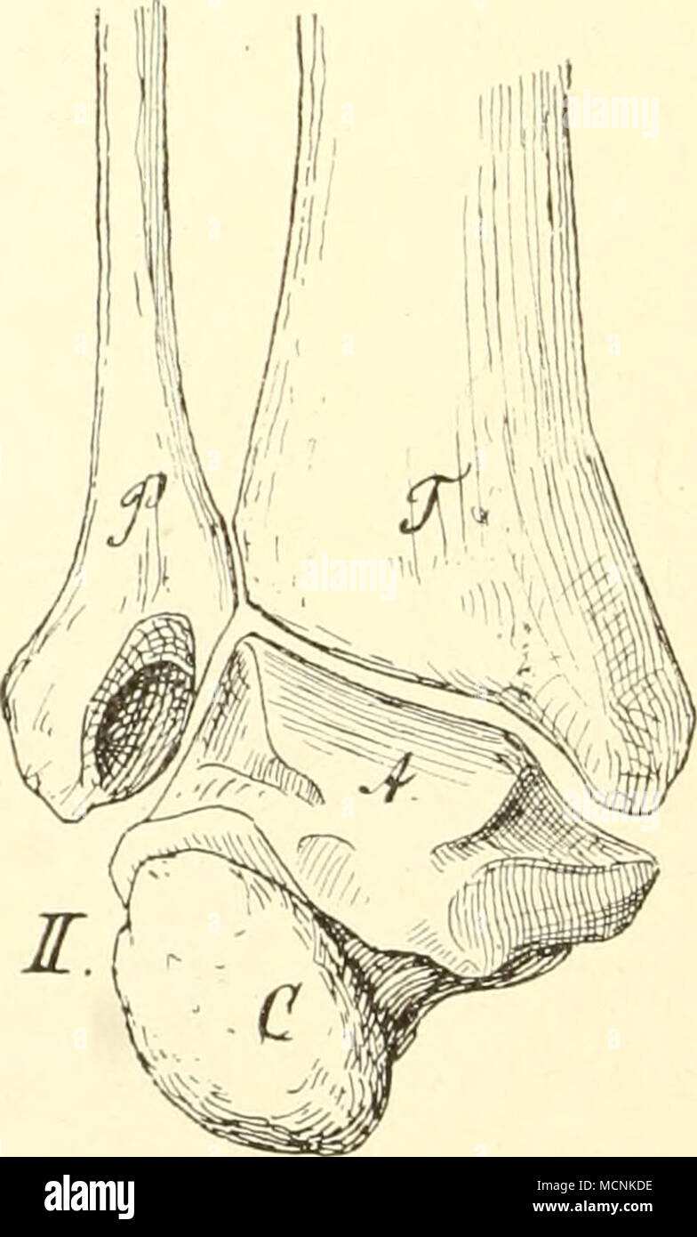 . Fig. .")63. Ho Fußgelenk vom Menschen, II vom (lorilla; nach Topinard. 7" Tibia; P Fibula; un astragalo; C Calcagno. menschlicher, als bei Hylobates durch größere Breite der Ilia, die konkav ventrale sind und durch größere Weite und der Kürze Beckenhöhle. Die Hinterextremität endet in einem anatomisch echten Fuß, der, olterflächlich Foto Stock