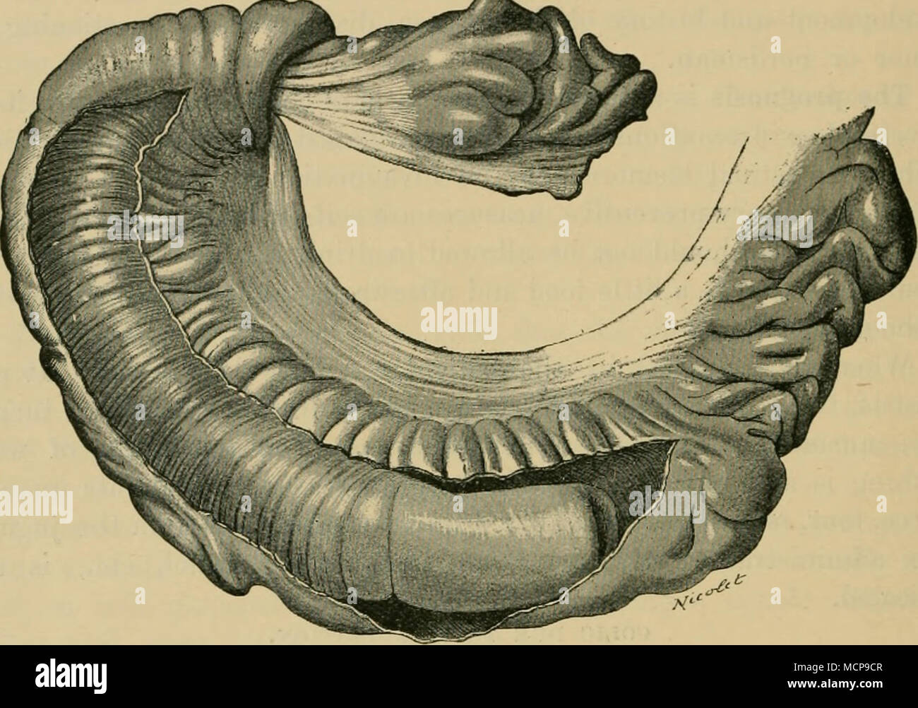 . Figura 68.-Invagination tlie di intestino in un bue (la porzione di strozzatura è stata incisa longitudinalmente). posizione su un piano inclinato all'indietro, la porzione ristretta può scivolare nella sezione dilatata dietro di esso. Invagination può verificarsi anche senza alcuna causa apparente, anche negli animali in piedi la stabile. Sintomi. L'attacco si verifica sempre improvvisamente si sviluppa rapidamente ed è di una gravissima carattere. La colica conies su mentre la polizia sta lavorando, spostando circa, o di riposo, secondo le circostanze e in un primo momento ricorda che a causa di congestione. In seguito diventa molto violente; t Foto Stock