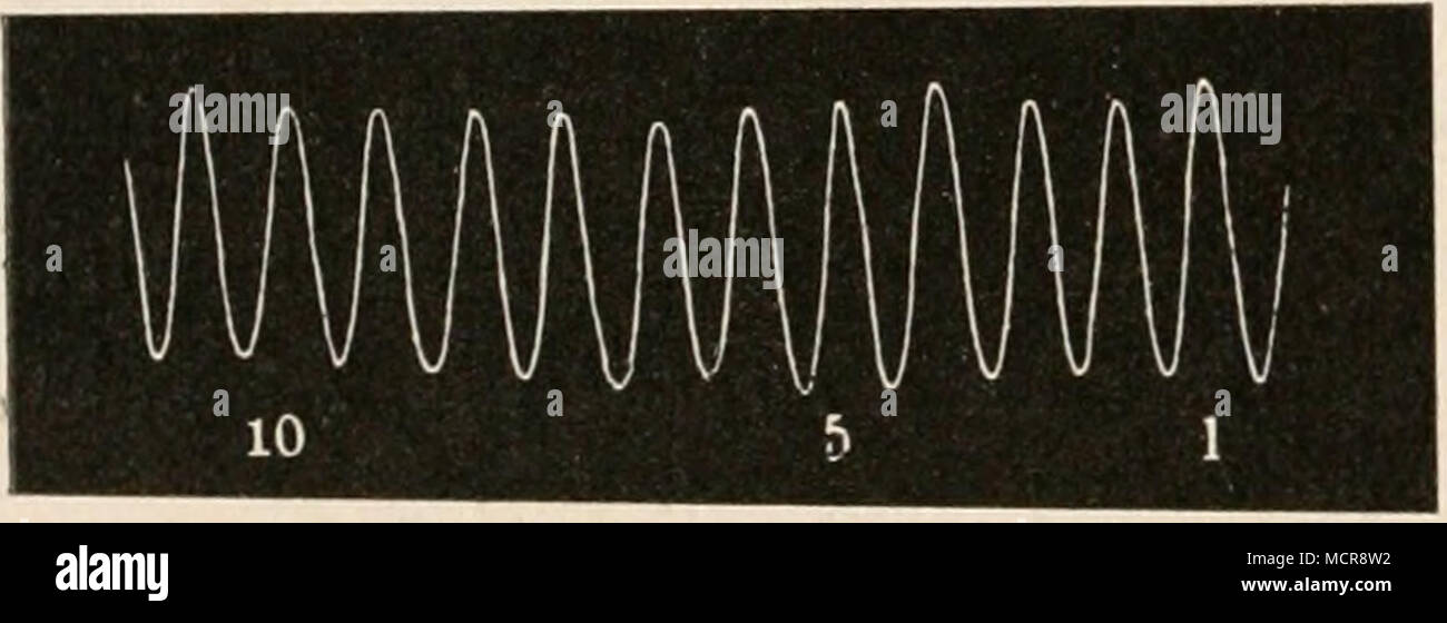 . Fig. 66. Radialiskurve. Nach Vierordt. Foto Stock