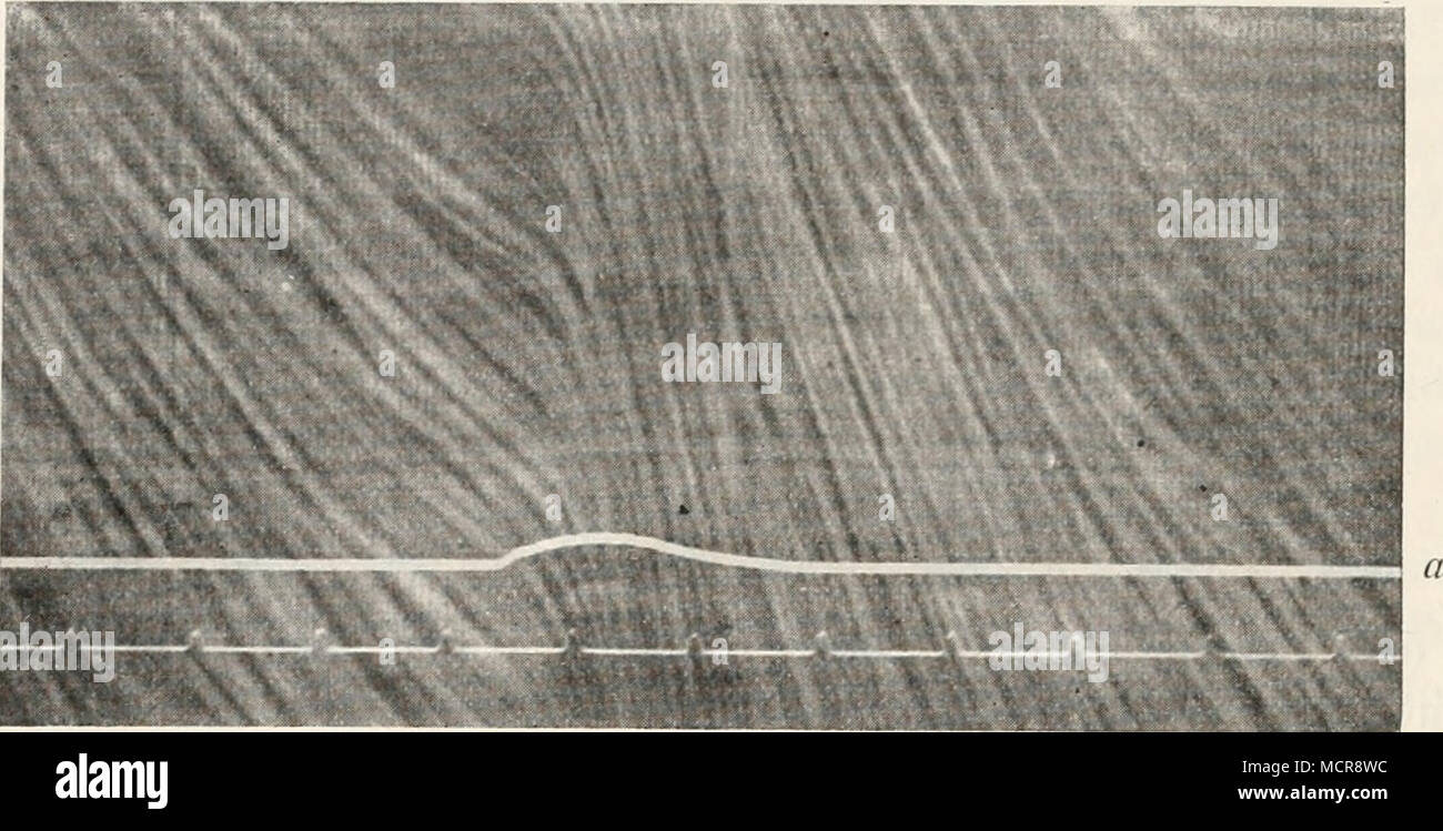 . Fig. 458. Die Bewegung der roten Blutkörperchen in einer kleinen Mesenterialarterie. Nach Hibthle. Un, der Druck in der A. pulmo-cutanea. Von links nach rechts zu lesen. Foto Stock