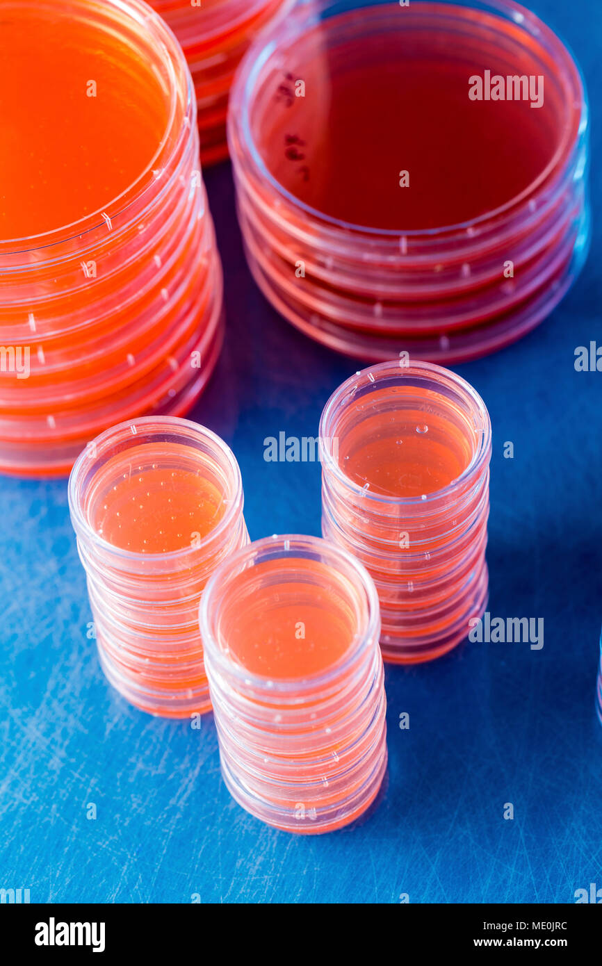 Piastre di agar. Pile di piastre di Petri con agar coltivato. Foto Stock