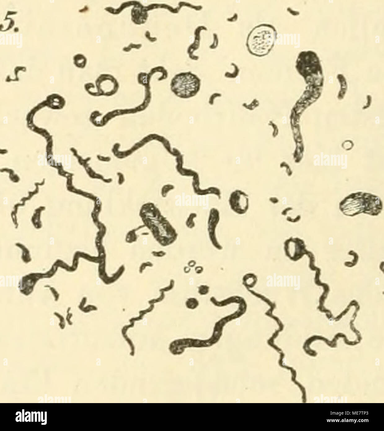 . Die mikroorganismen. Mit besonderer berücksichtigung der ätiologie der infektionskrankheiten . Fig. 11. Unregelmassige Bildungen tlnvolutionsl'oimen). Vewgr. c. 1000. 1. Von B. Proteus mirabilis (Hauser). 2. Von Bac. aceticus (Hansen). 3. Spirulinenbildung bei Bac. anthracis (Petruschky). 4. Involutionsfornien von Bac. balophilus (Russell). 5. Von Spirillum cbolerae (VAN ERMENGHEM). Im einzelnen sind etwa folgende bemerkenswerte Abweichungen von der typischen forma zu verzeichnen (Fig. 11). In alten Kulturen von Kokken begegnet man oft Individuen von ausserordentlich verschiedener Grösse, ebe Foto Stock