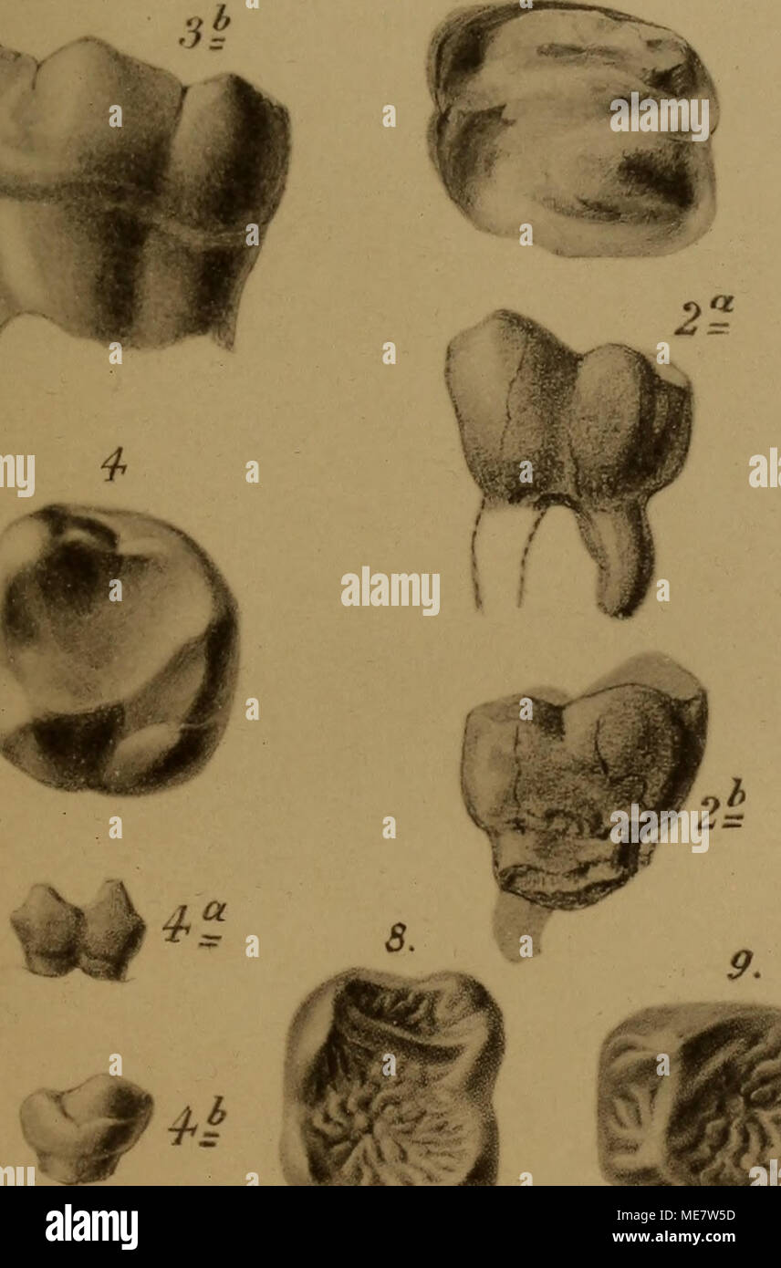 . Die menschenähnlichen Zähne aus dem Bohnerz der Schwäbischen Alb . Foto Stock