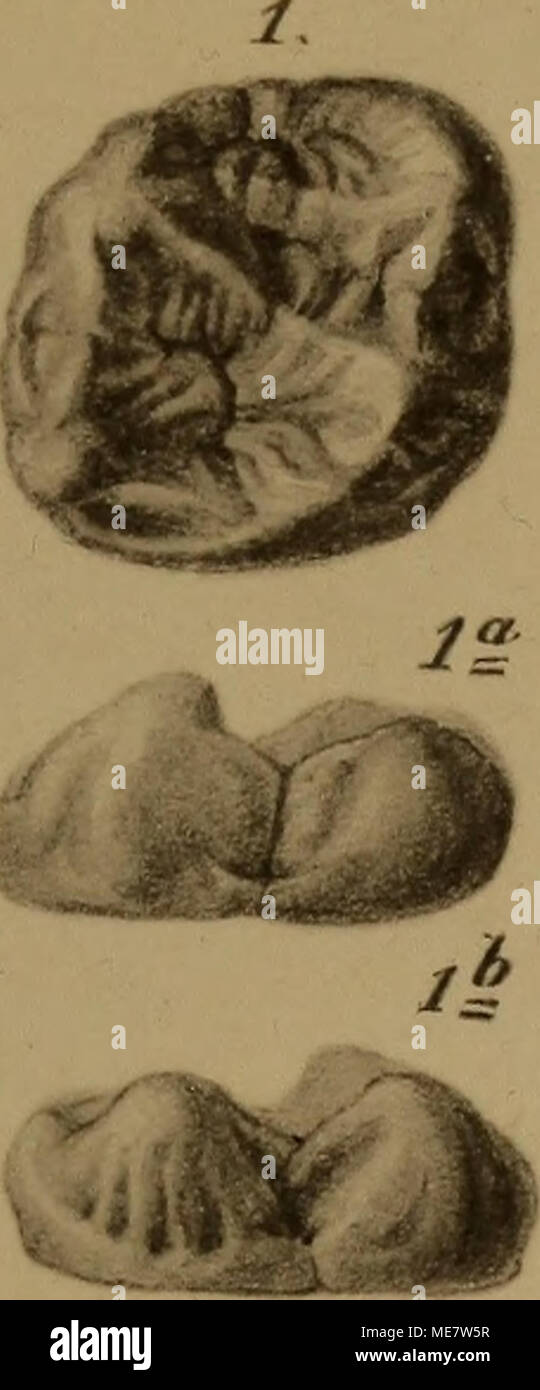 . Die menschenähnlichen Zähne aus dem Bohnerz der Schwäbischen Alb . Foto Stock