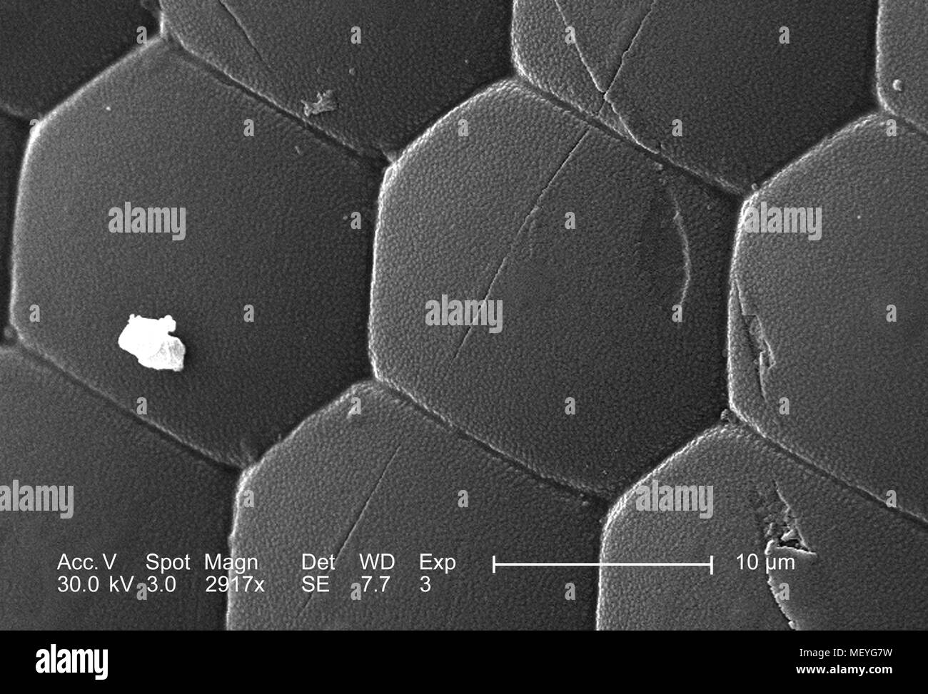 Western honeybee (Apis mellifera) occhio composto, raffigurato nel 2917x di scansione ingrandita al microscopio elettronico (SEM) immagine, 2005. Immagine cortesia di centri per il controllo delle malattie (CDC) / Janice Haney Carr, Connie di fiori e di Pamela Munn della International Bee Research Association, IBRA. () Foto Stock