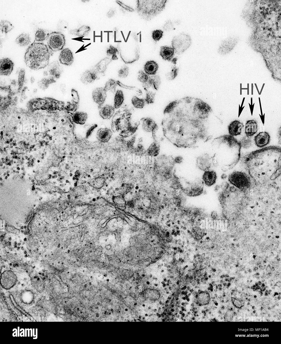 La presenza di entrambi i di leucemia a cellule T umana di tipo 1 (virus HTLV-1) e il virus di immunodeficienza umana (HIV) ha rivelato nella trasmissione microscopiche di elettroni (TEM) immagine, 1980. Immagine cortesia di centri per il controllo delle malattie (CDC) / Cynthia Goldsmith. () Foto Stock
