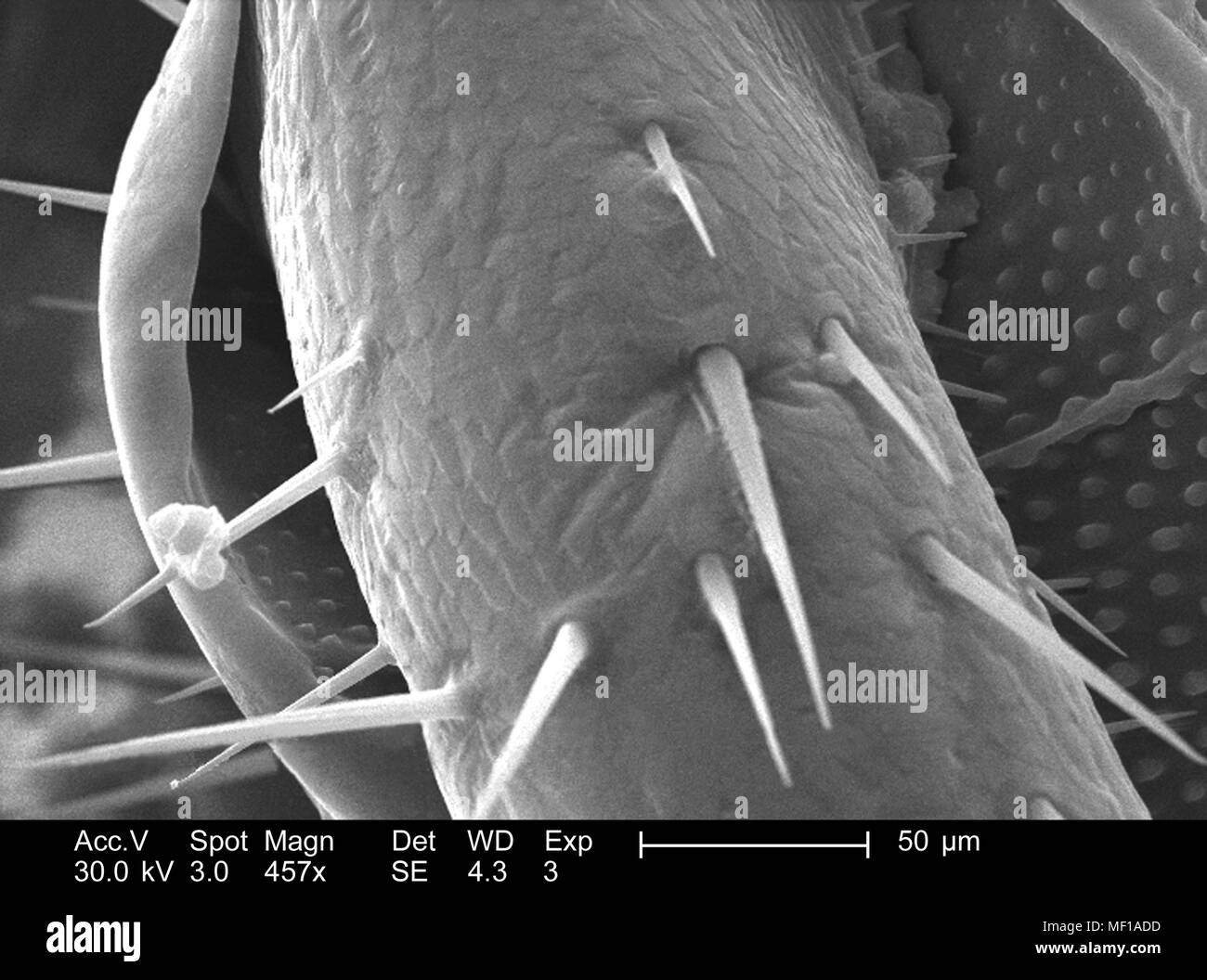 Exoskeletal superficie di un misterioso roach, raffigurato nella 457x di scansione ingrandita al microscopio elettronico (SEM) immagine, 2005. Immagine cortesia di centri per il controllo delle malattie (CDC) / Janice Haney Carr. () Foto Stock