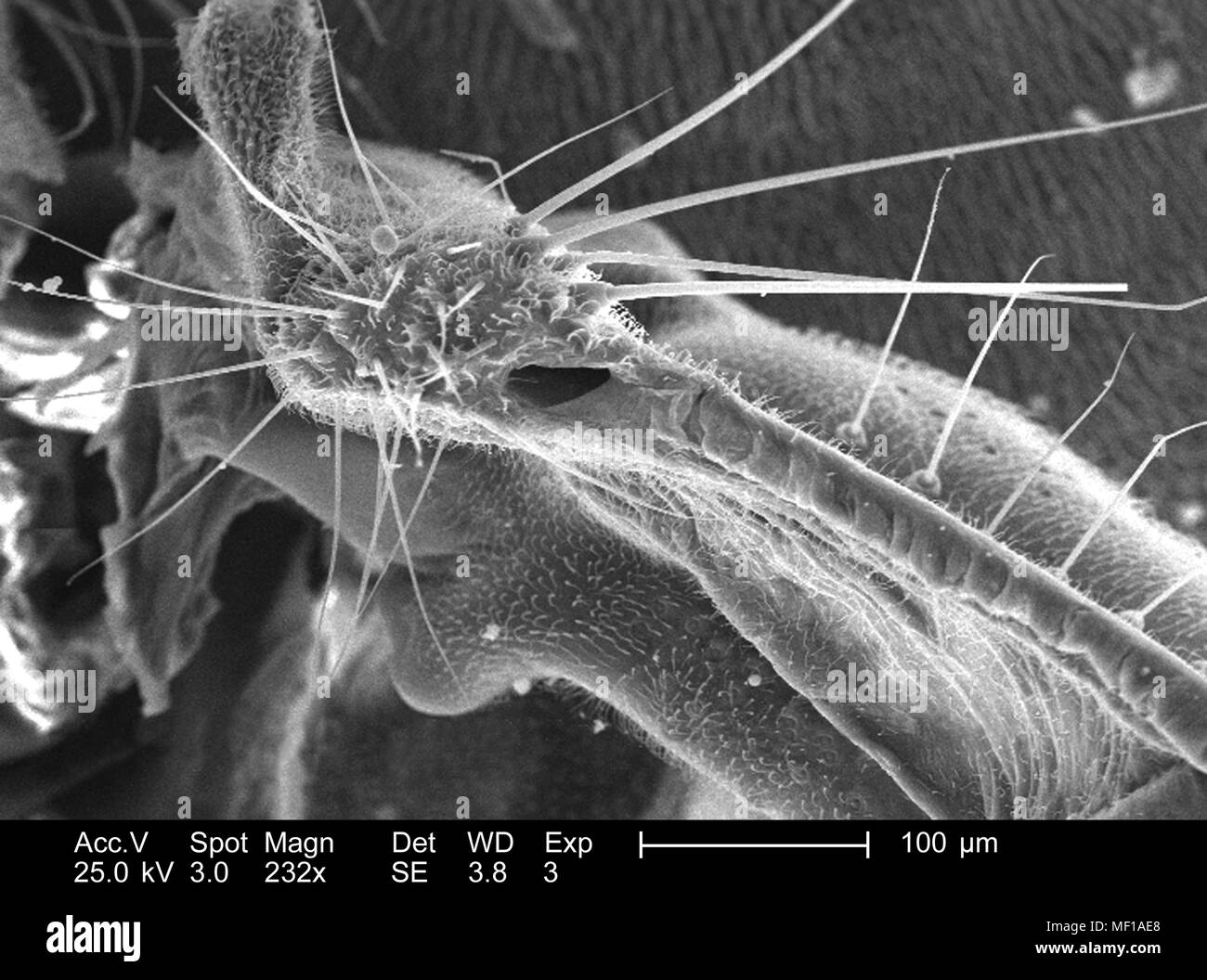 Dettagli morfologiche e i peli sensoriali (Setae) trovati su un parafango attacco di una libellula, raffigurato nella 232x di scansione ingrandita al microscopio elettronico (SEM) immagine, 2005. Immagine cortesia di centri per il controllo delle malattie (CDC) / Janice Haney Carr, Connie fiori. () Foto Stock