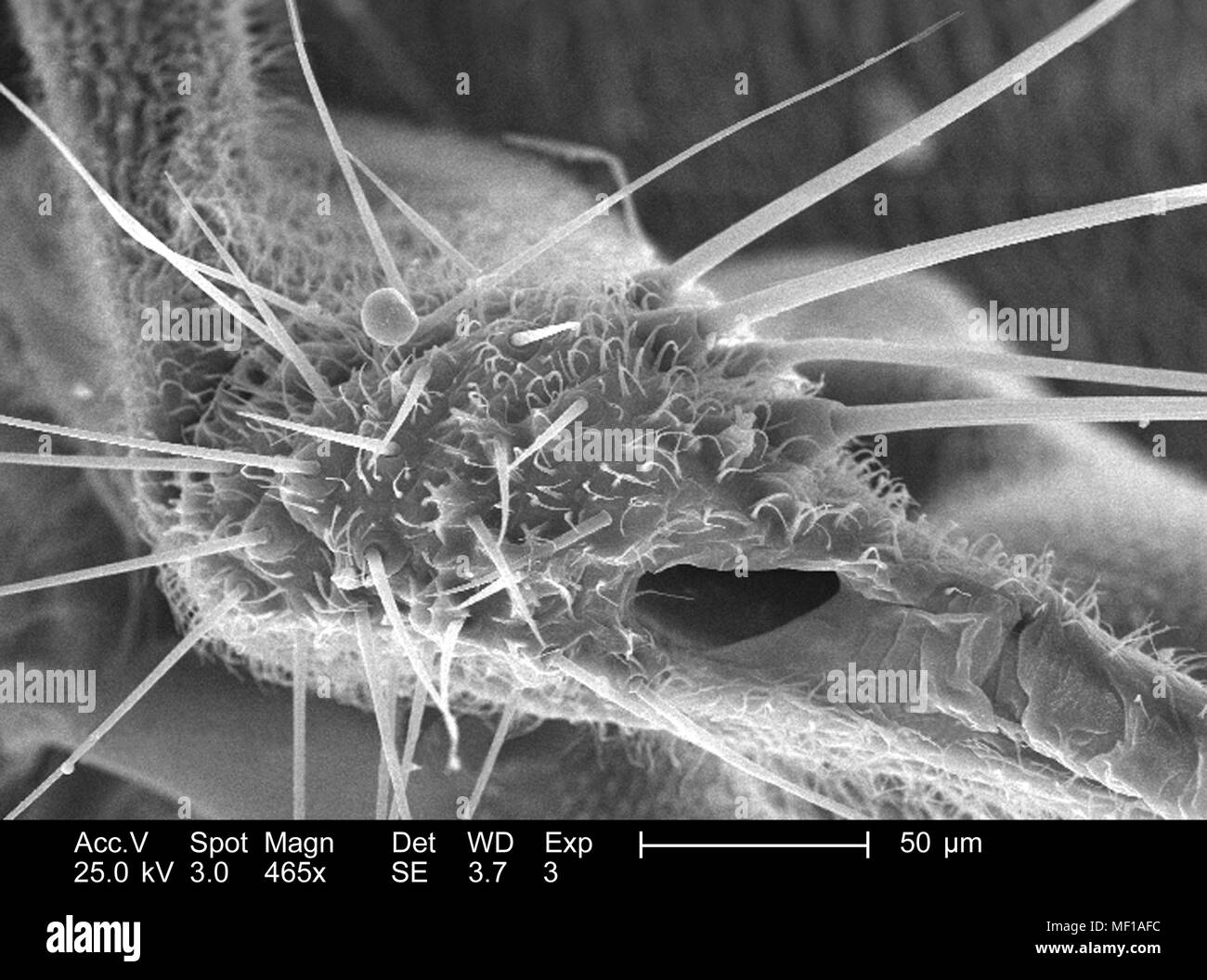 Dettagli morfologiche e i peli sensoriali (Setae) trovati su un parafango attacco di una libellula, raffigurato nella 465x di scansione ingrandita al microscopio elettronico (SEM) immagine, 2005. Immagine cortesia di centri per il controllo delle malattie (CDC) / Janice Haney Carr, Connie fiori. () Foto Stock