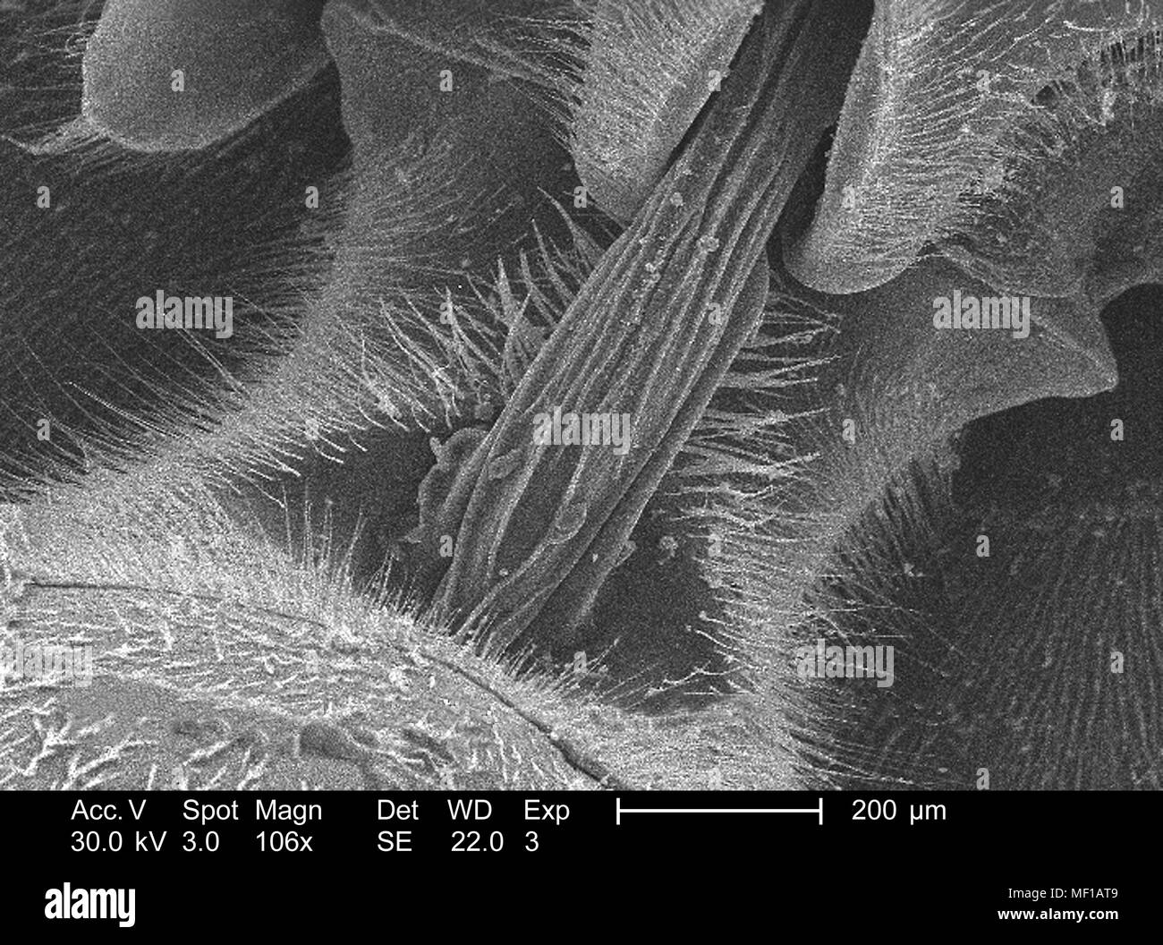 Caratteristiche morfologiche di un misterioso wasp cervice, raffigurato nella 106x di scansione ingrandita al microscopio elettronico (SEM) immagine, 2005. Immagine cortesia di centri per il controllo delle malattie (CDC) / Janice Haney Carr. () Foto Stock