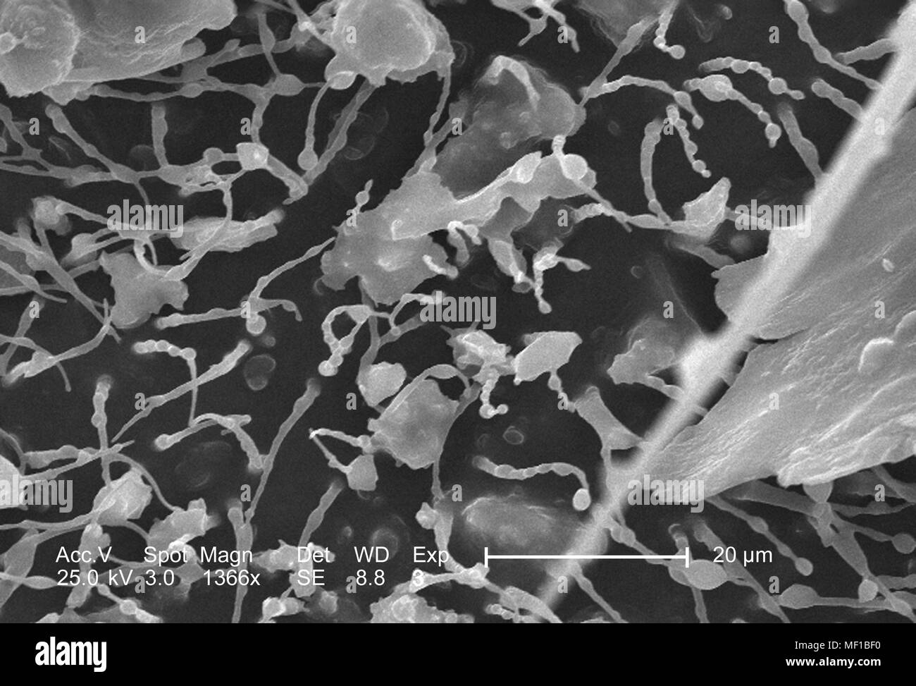 I peli sensoriali (setae) coprendo una libellula chitinous esoscheletro, raffigurato nel 1366x di scansione ingrandita al microscopio elettronico (SEM) immagine, 2005. Immagine cortesia di centri per il controllo delle malattie (CDC) / Janice Haney Carr, Connie fiori. () Foto Stock