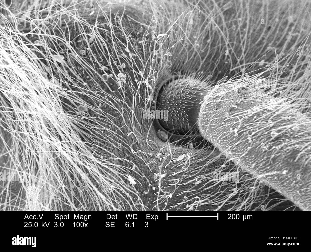 Dettagli morfologiche degli insetti non identificati, testa a snodo sferico di tipo sferico, raffigurato nella 100x di scansione ingrandita al microscopio elettronico (SEM) immagine, 2005. Immagine cortesia di centri per il controllo delle malattie (CDC) / Janice Haney Carr. () Foto Stock