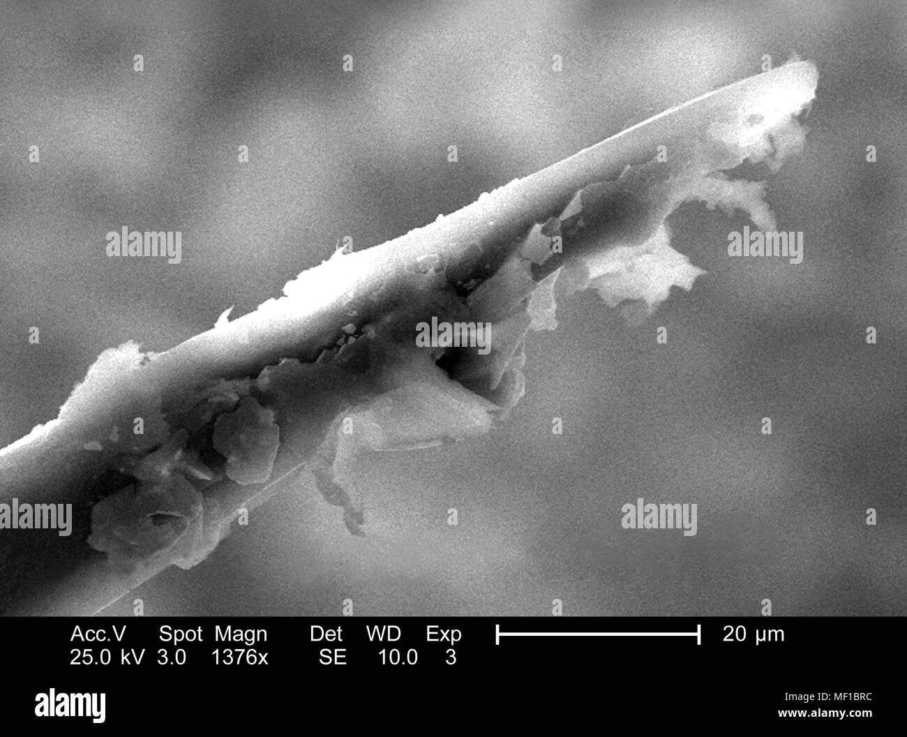 Ultrastrutturali dettagli morfologiche di un misterioso hymenopteran insetto apparato stinger, raffigurato nel 1376x di scansione ingrandita al microscopio elettronico (SEM) immagine, 2005. Immagine cortesia di centri per il controllo delle malattie (CDC) / Janice Haney Carr. () Foto Stock