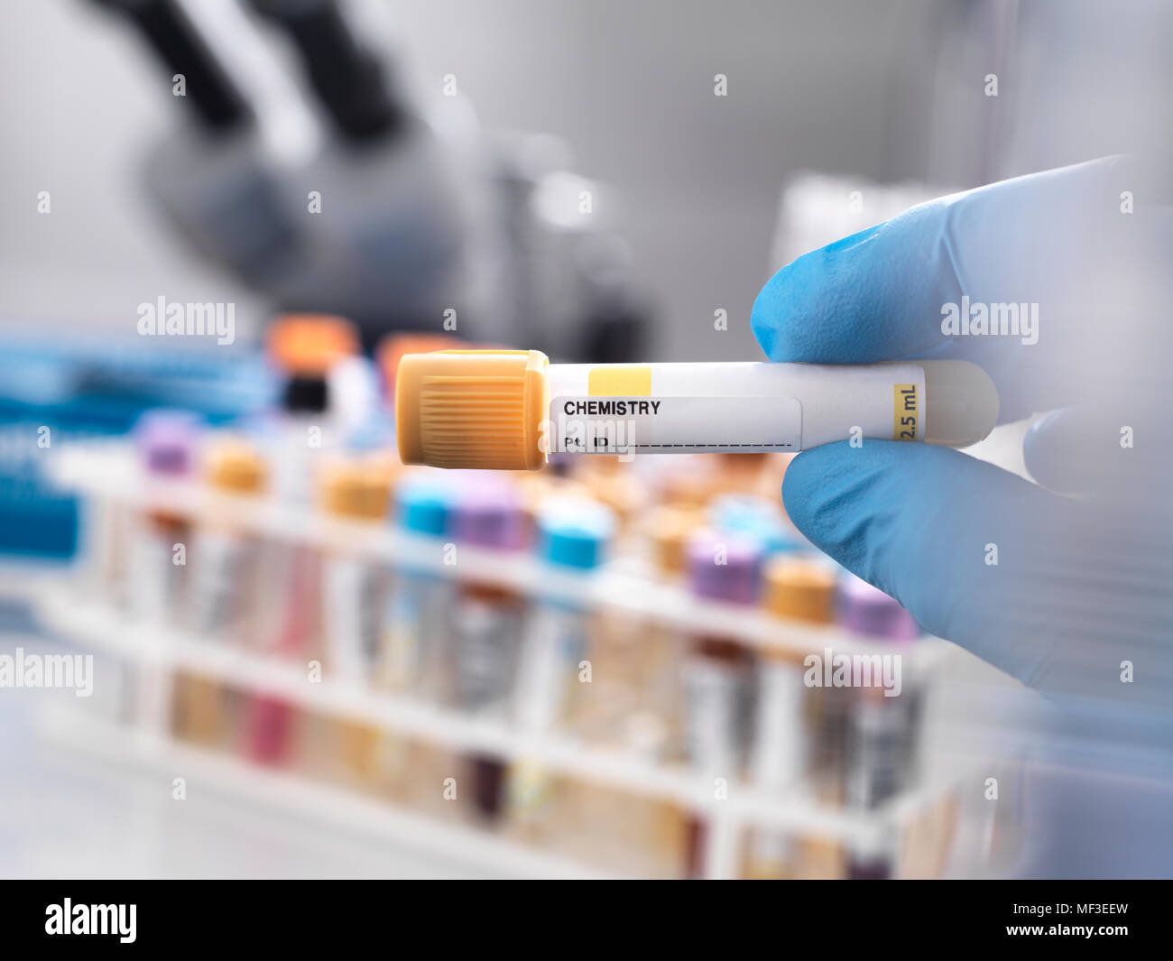 Operatore medico preparare una chimica umana campione per la sperimentazione clinica Foto Stock