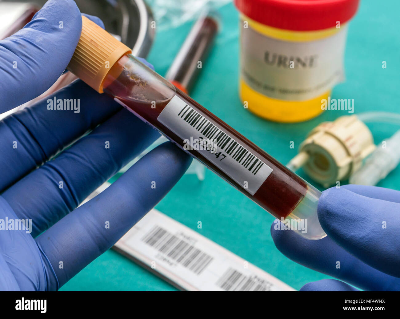 Medico detiene il campione di sangue in un ospedale tabella, immagine concettuale Foto Stock