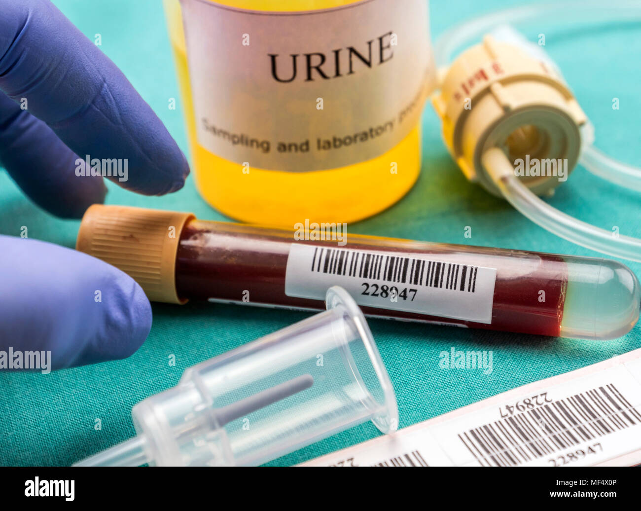 Medico detiene il campione di sangue in un ospedale tabella, immagine concettuale Foto Stock