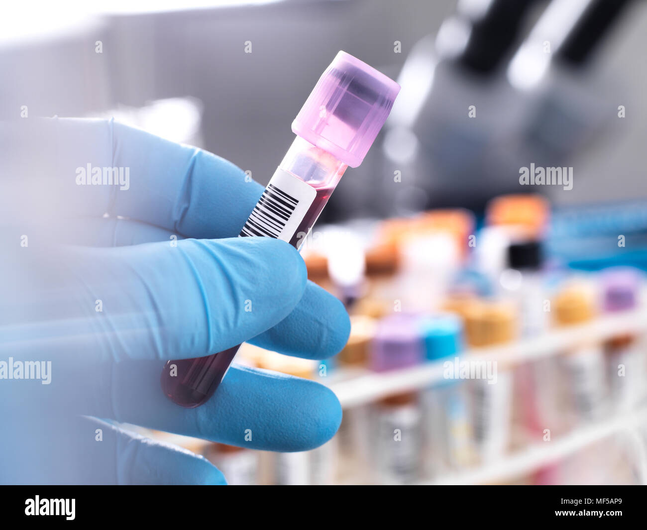 Tecnico medico di preparazione di un campione di sangue umano per la sperimentazione clinica Foto Stock