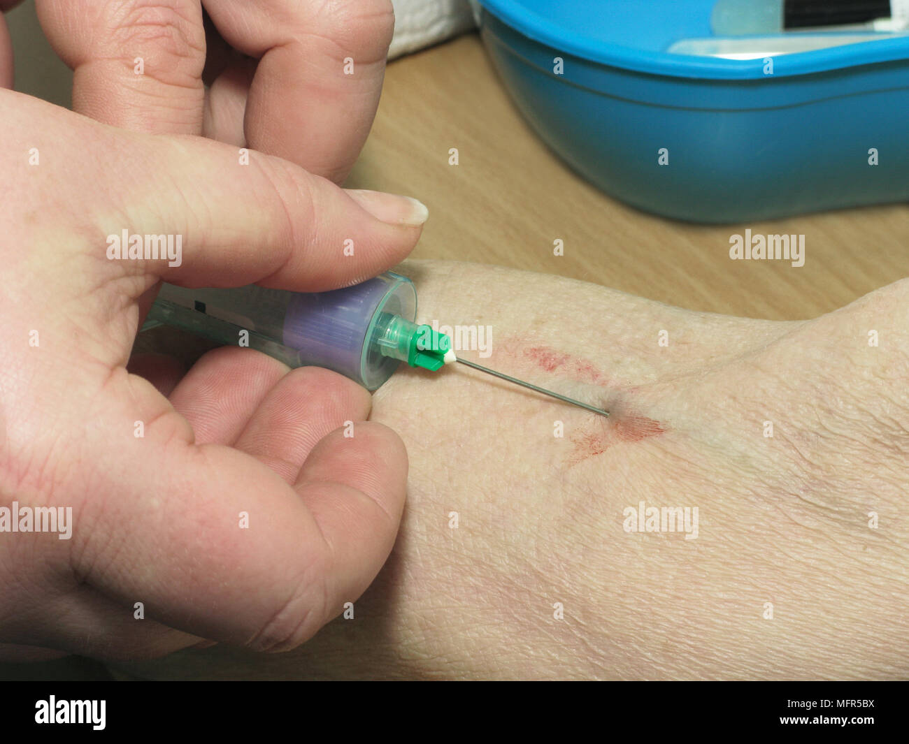 Donna anziana avente un esame di sangue prelevato (esami del sangue sono ora una funzione periodica per il monitoraggio di diverse condizioni) Foto Stock