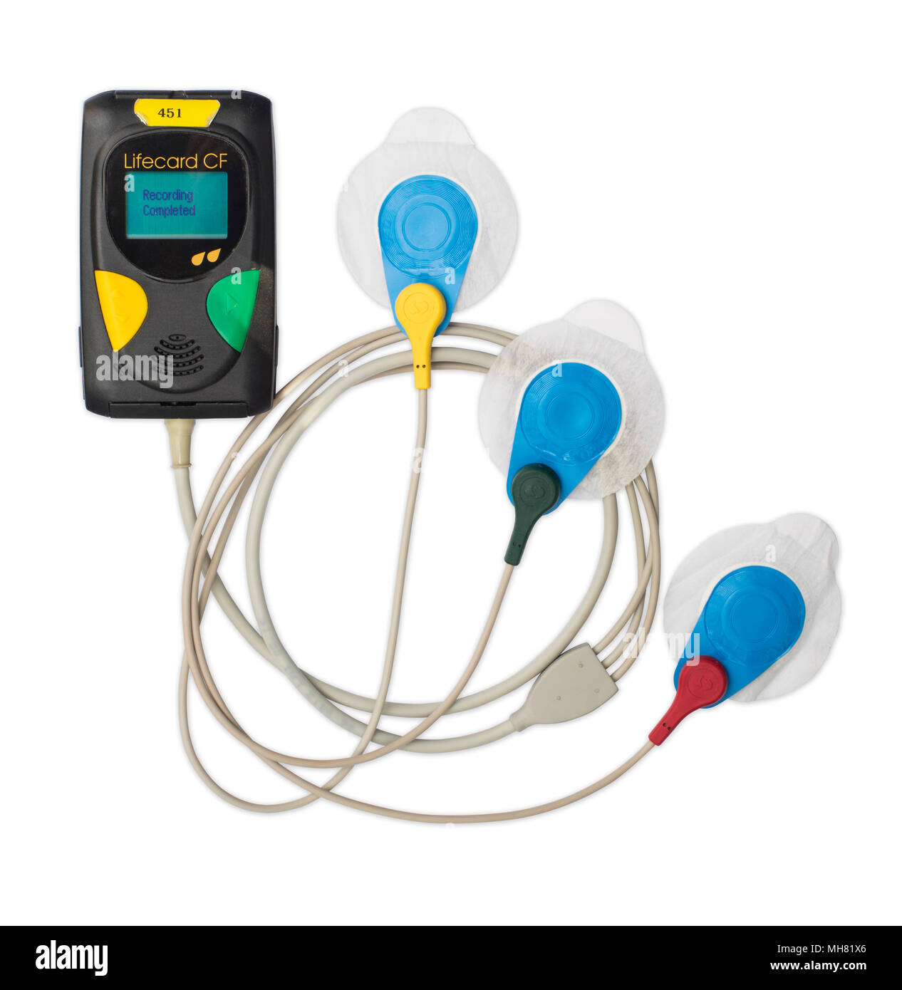 Un elettrocardiogramma portatile monitor cardiaco Foto Stock