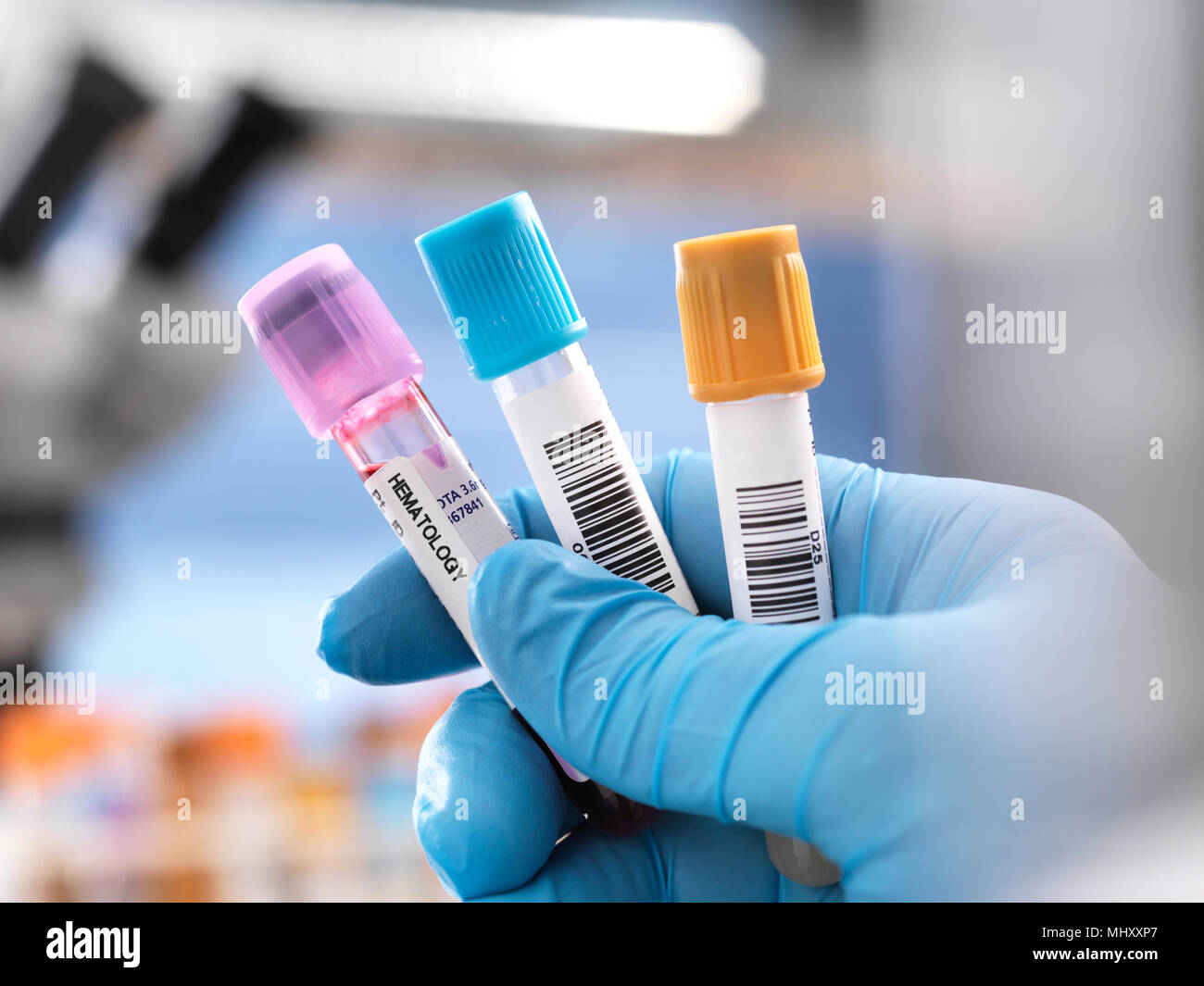 Vista ritagliata del medico tenendo i flaconcini contenenti campioni umani Foto Stock