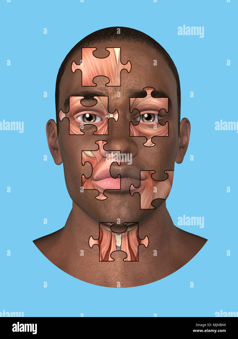 Anatomia vista frontale dei grandi muscoli facciali di un uomo. Foto Stock
