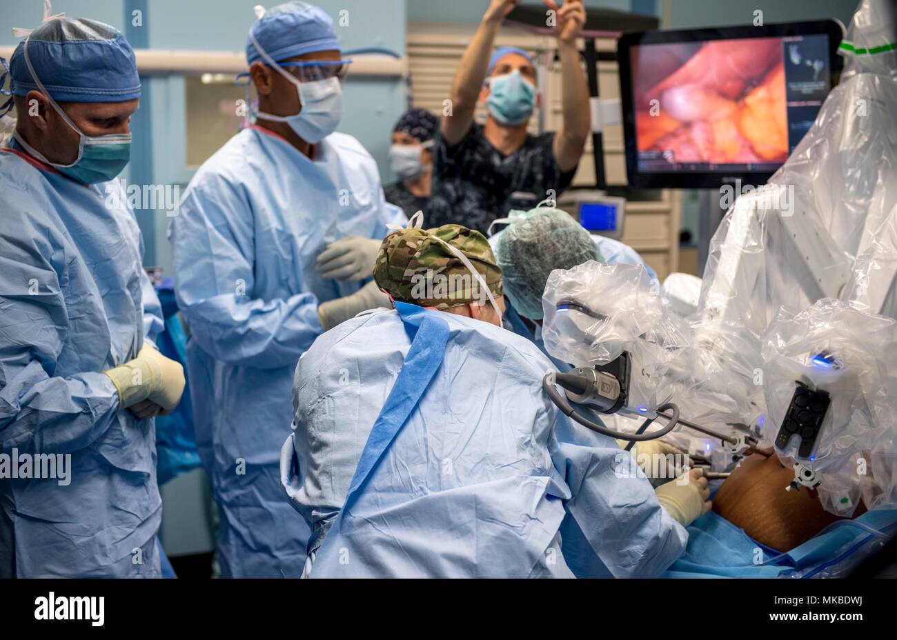 180504-N-RM689-0125 Trincomalee, Sri Lanka (4 maggio 2018) personale chirurgico assegnati ai militari di comando Sealift nave ospedale USNS misericordia (T-AH 19) per Pacific Partnership 2018 (PP18) e dello Sri Lanka team chirurgico dall ospedale Base Mutur collegare le sonde di Da Vinci XI Robot sistema chirurgico ad un paziente durante il primo robot-chirurgia assistita mentre a bordo della misericordia. PP18's missione è lavorare collettivamente con host e nazioni partner per migliorare l'interoperabilità a livello regionale di emergenza e capacità di risposta, aumentare la stabilità e la sicurezza nella regione e incoraggiare i nuovi e duraturi gli amici Foto Stock