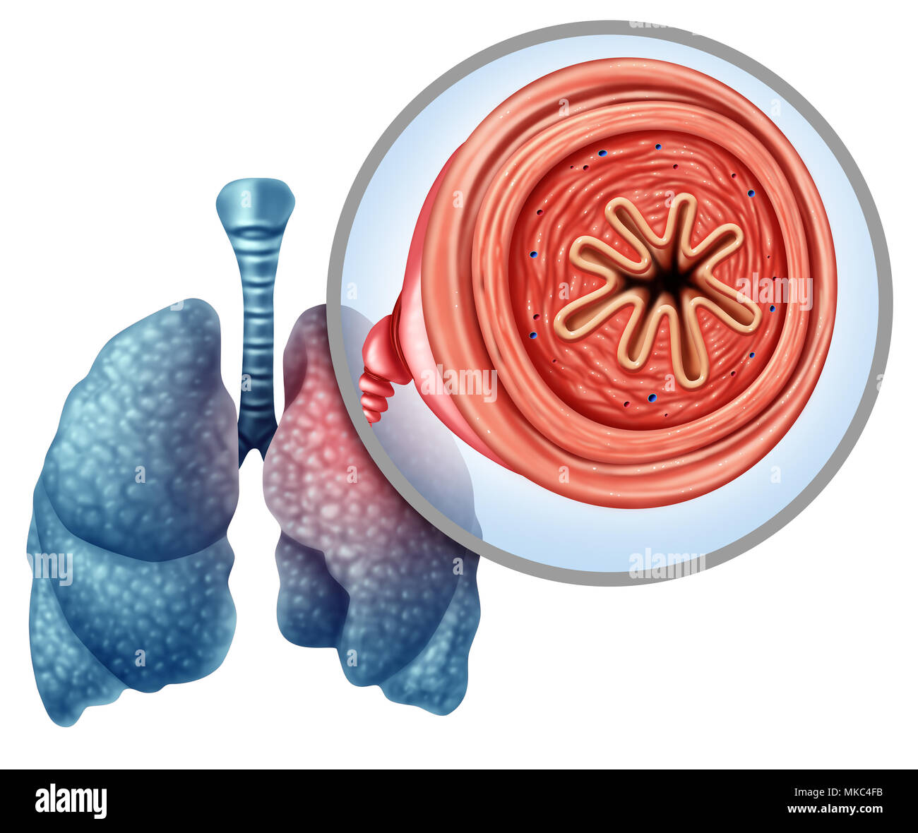 Bpco la malattia polmonare ostruttiva cronica come un concetto medico per malattia polmonare ed enfisema con 3D'illustrazione degli elementi. Foto Stock