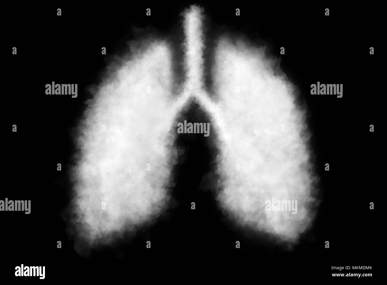 Illustrazione di un fumo tossico nel polmone . Foto Stock