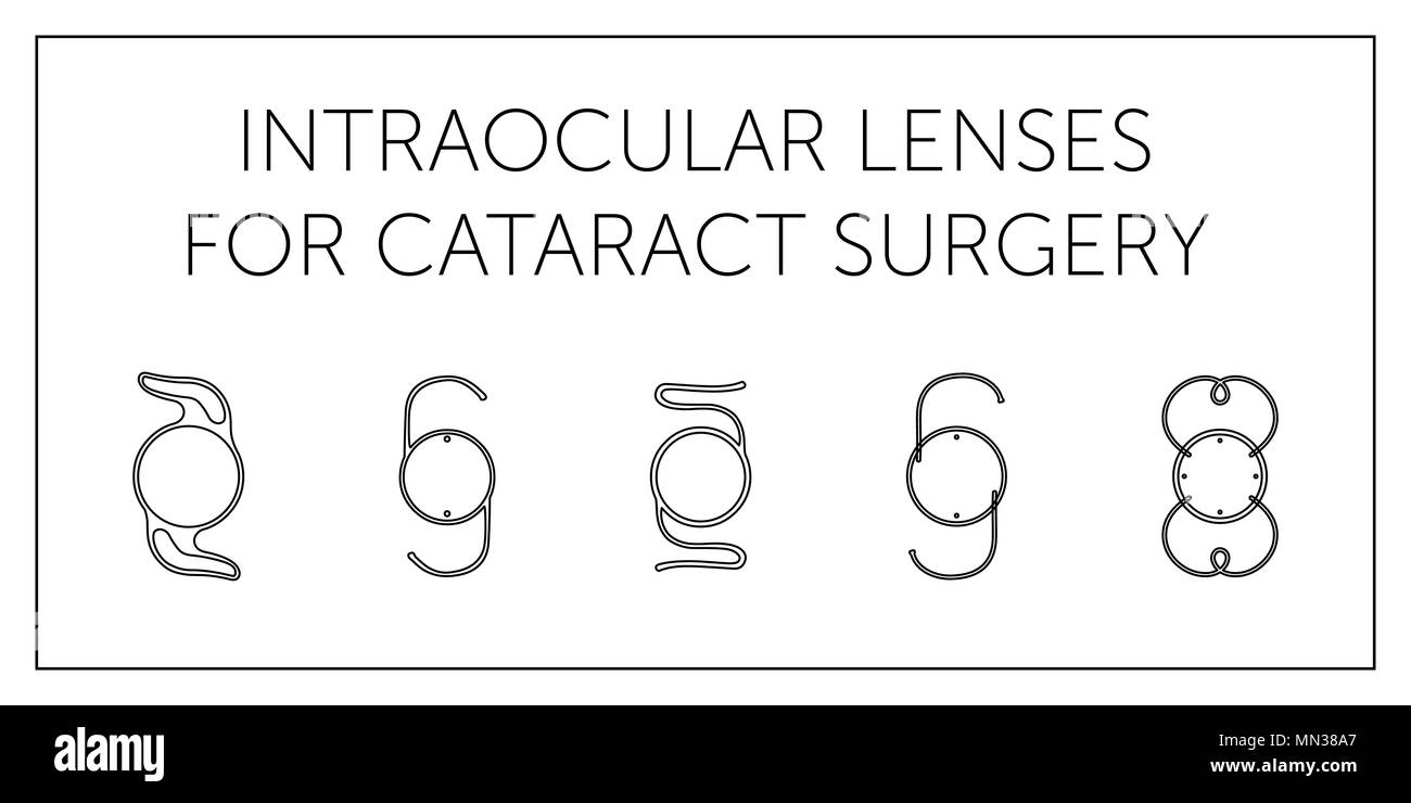 Serie di schemi di lenti intraoculari su sfondo bianco Illustrazione Vettoriale
