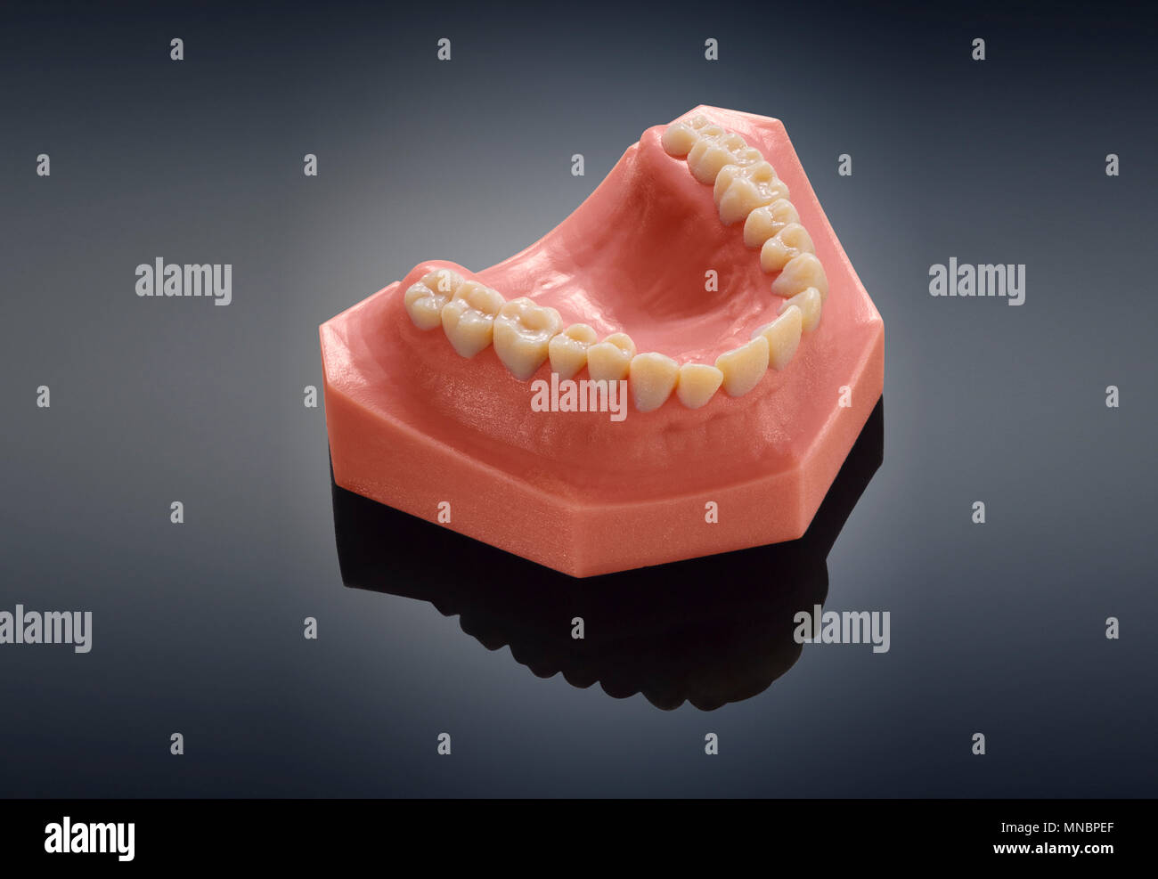 Odontoiatria dentale, modello di denti, diretto stampante 3D Foto Stock