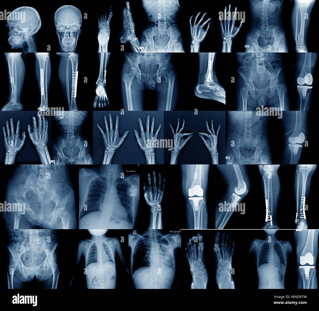 Raccolta di immagini a raggi x, cranio spalla, anca, ginocchio , la scoliosi spinne e giunto di piccole dimensioni nel contenuto Foto Stock