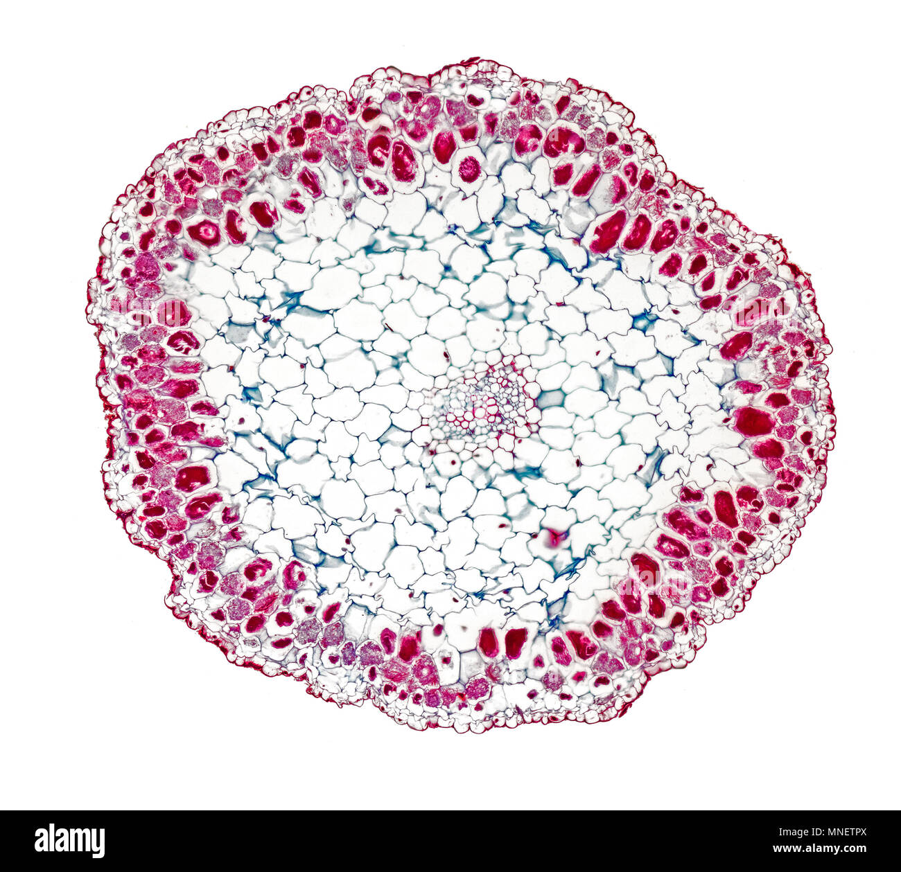 Nido di uccelli orchid root, TS, micorriza è un associazione simbiotica tra un fungo e le radici di un host vascolare impianto fotomicrografia in campo chiaro Foto Stock
