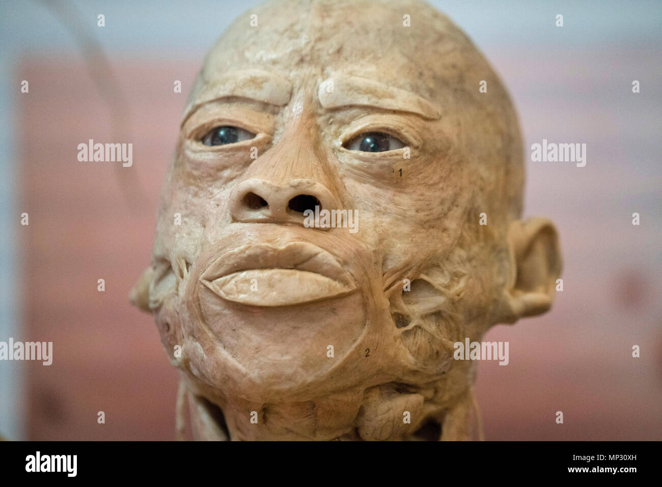 Anatomia di una vera e propria testa umana Foto Stock