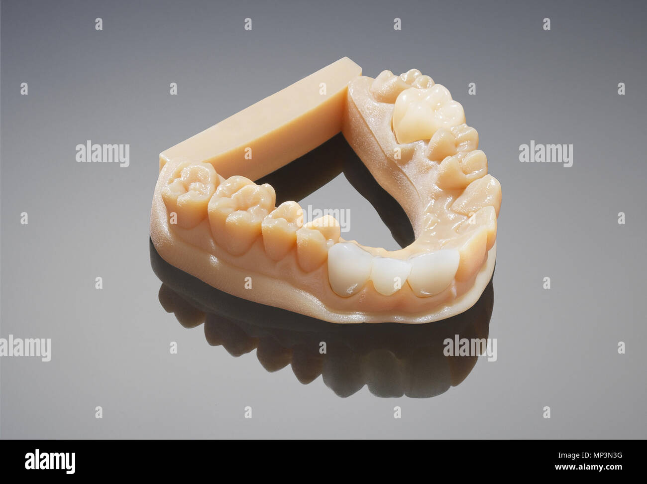 Dentale ortodontico e 3D modello di denti Foto Stock