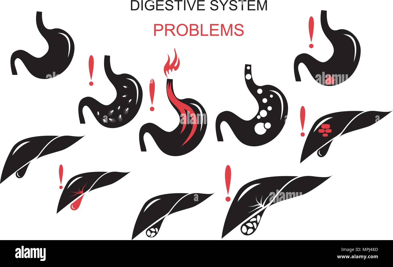 Illustrazione dei problemi del sistema digestivo Illustrazione Vettoriale