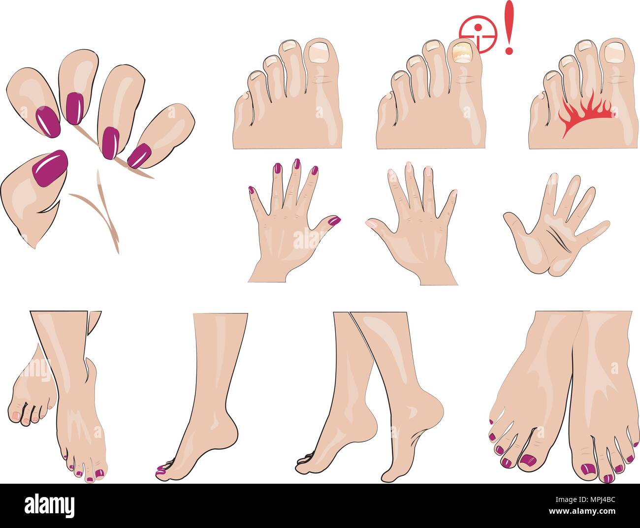 Le mani, i piedi e le unghie manicure, unghie sane e chiodo fungo Illustrazione Vettoriale